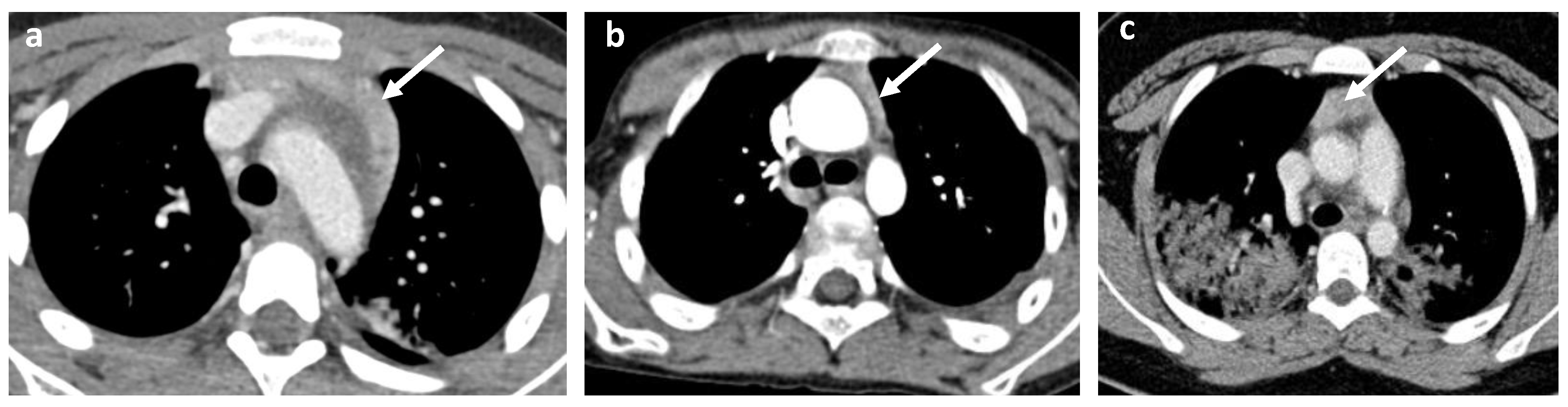 Gastroent 13 00032 g008