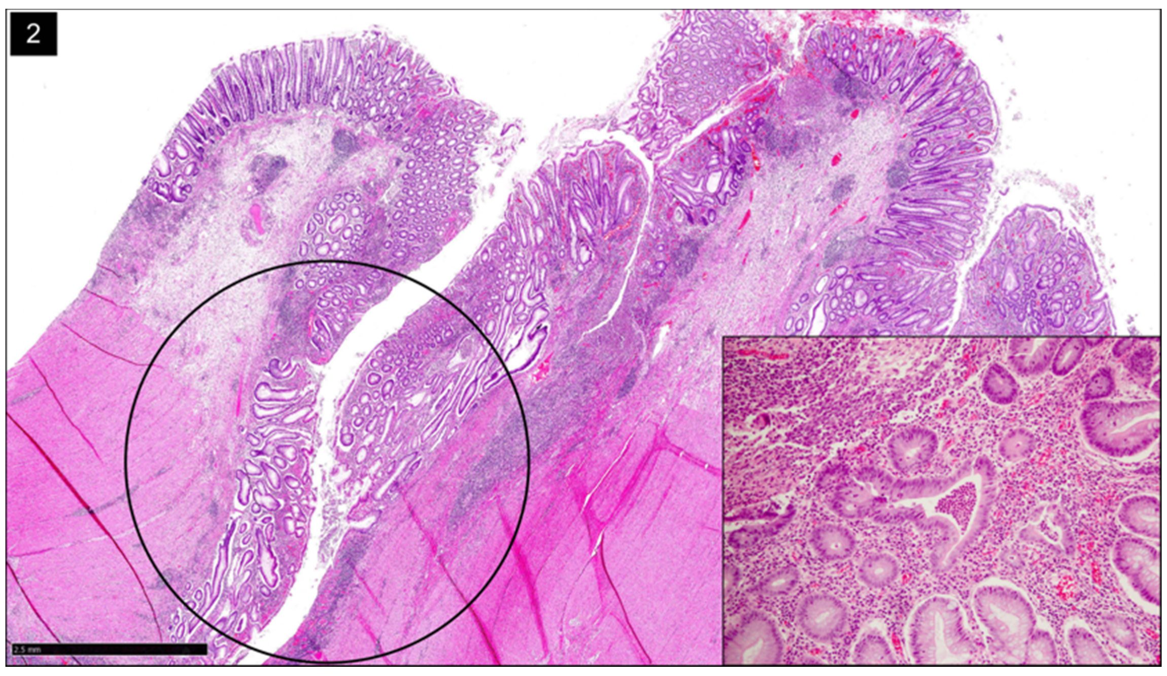 Gastroent 13 00033 g002