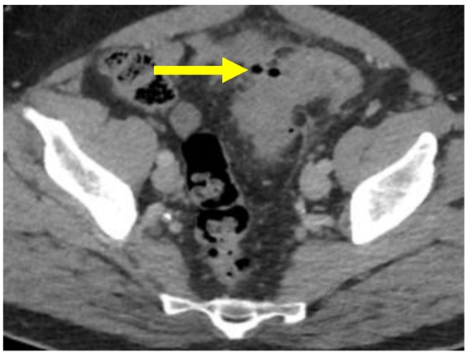 Gastroent 13 00033 g006