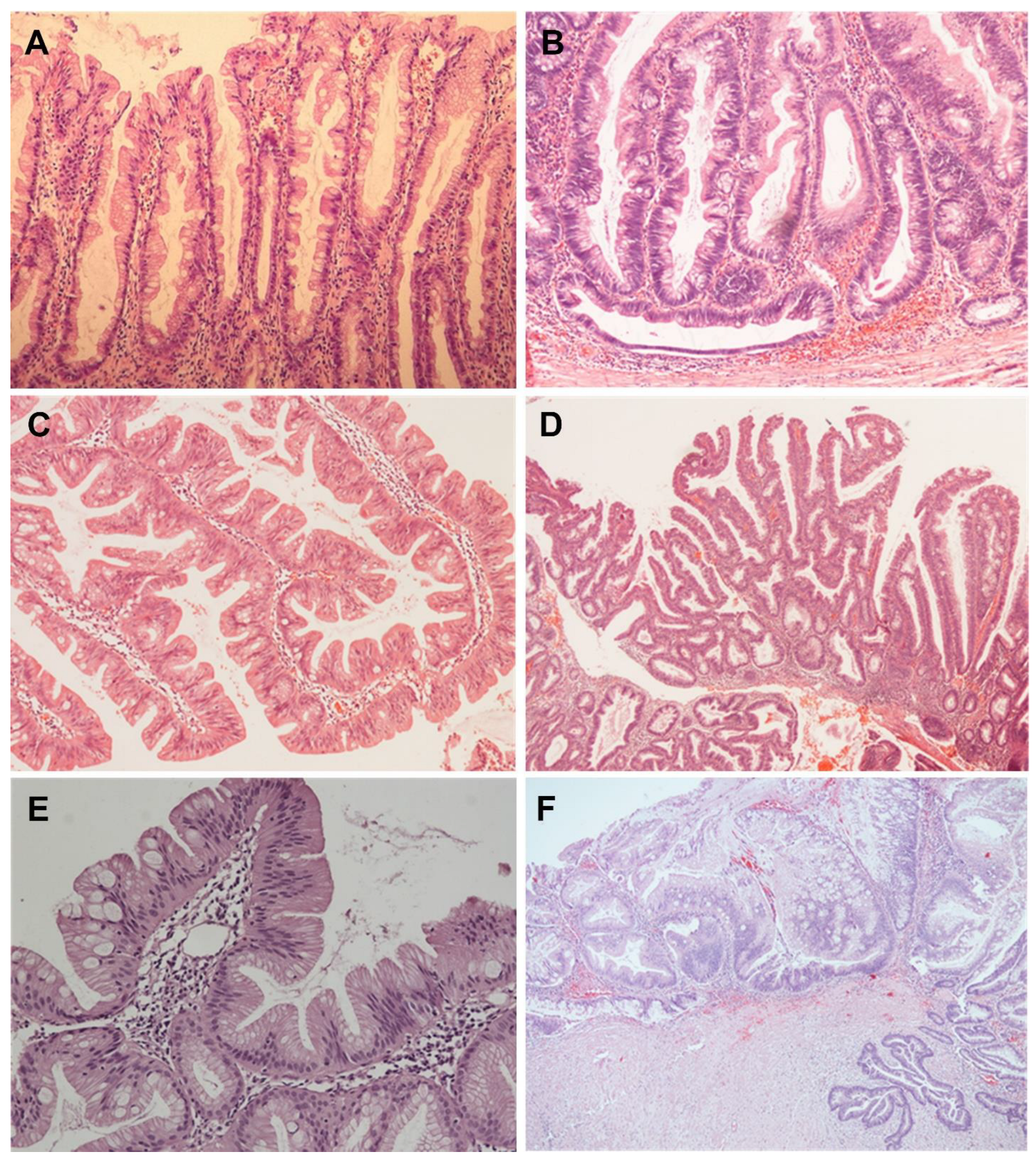 Gastroent 14 00008 g001