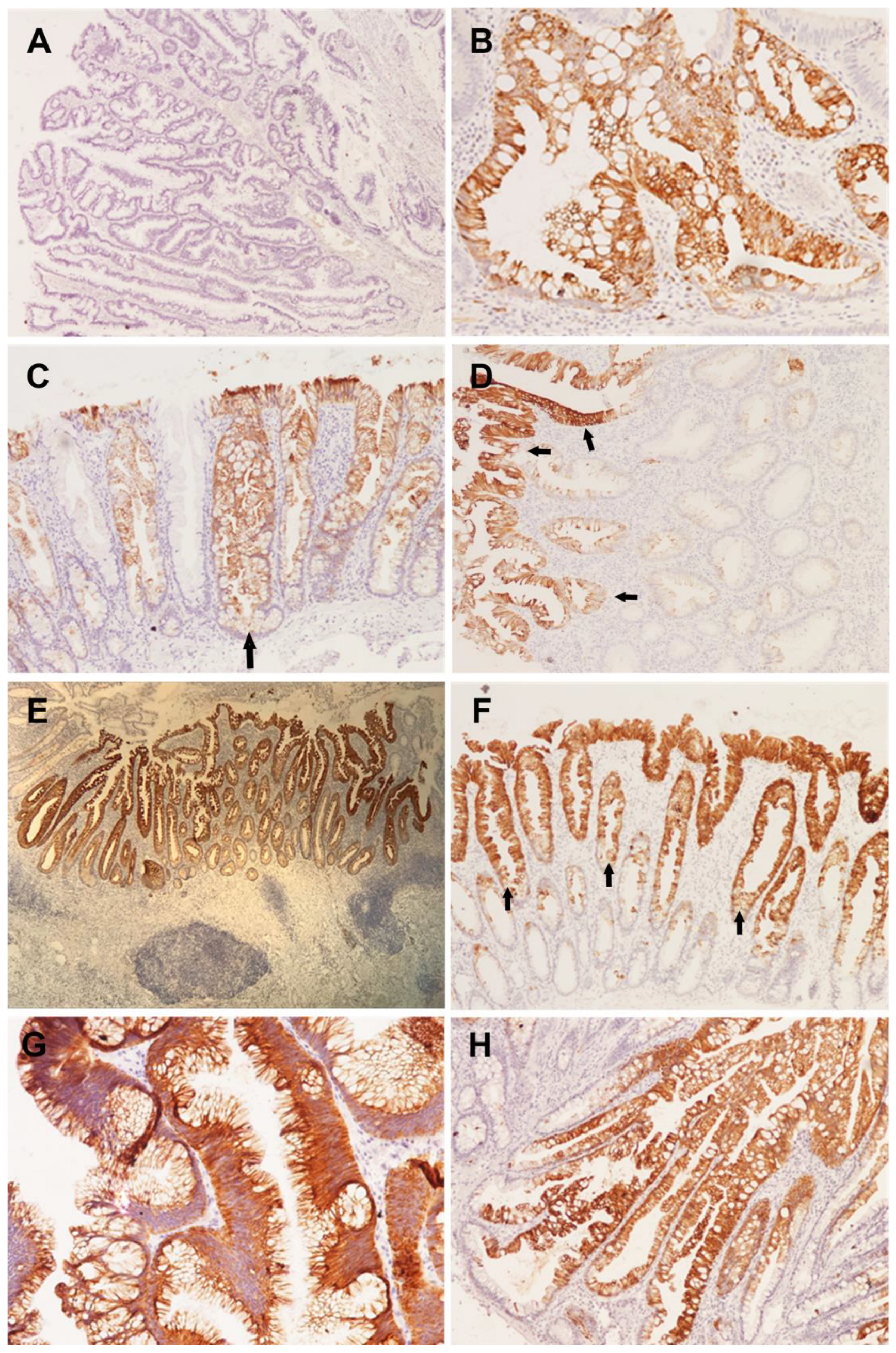 Gastroent 14 00008 g002