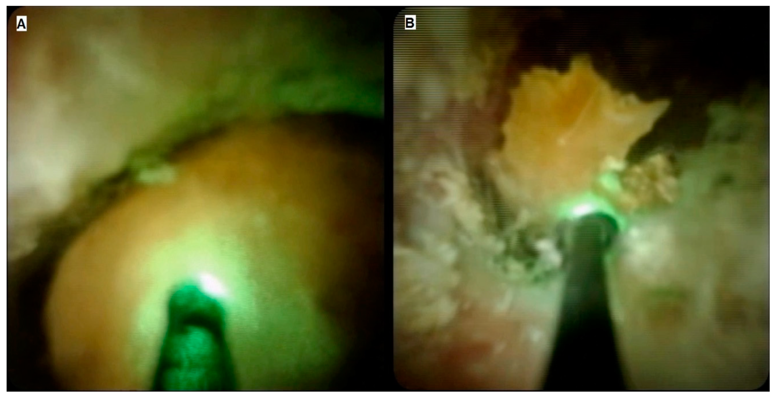 Gastroent 14 00009 g002