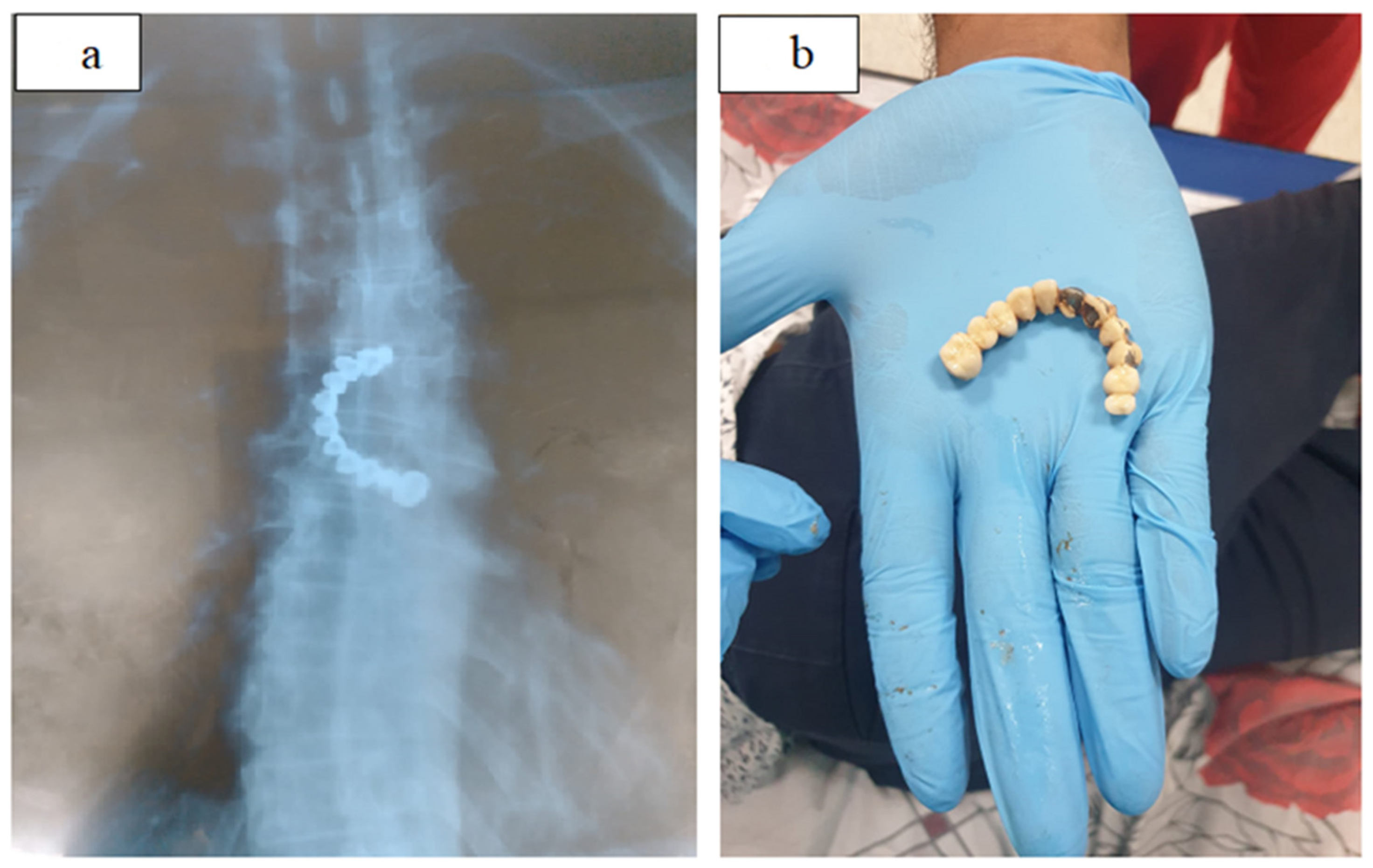 Gastroent 14 00010 g003 Gastroent 14 00010 g003
