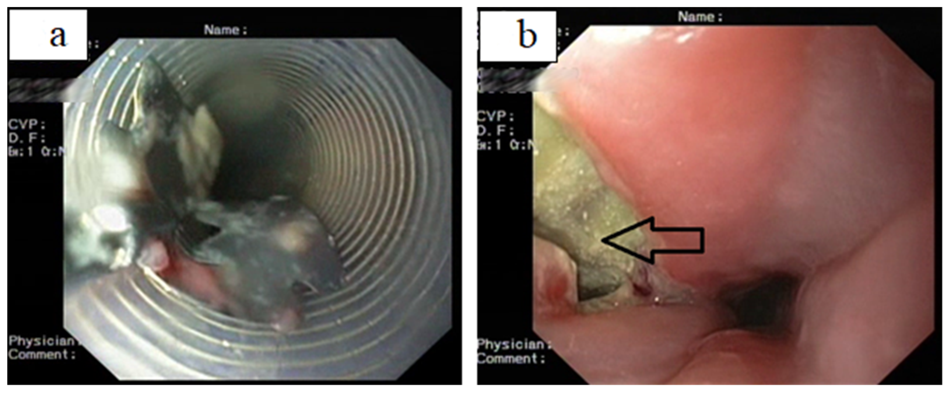 Gastroent 14 00010 g005 Gastroent 14 00010 g005