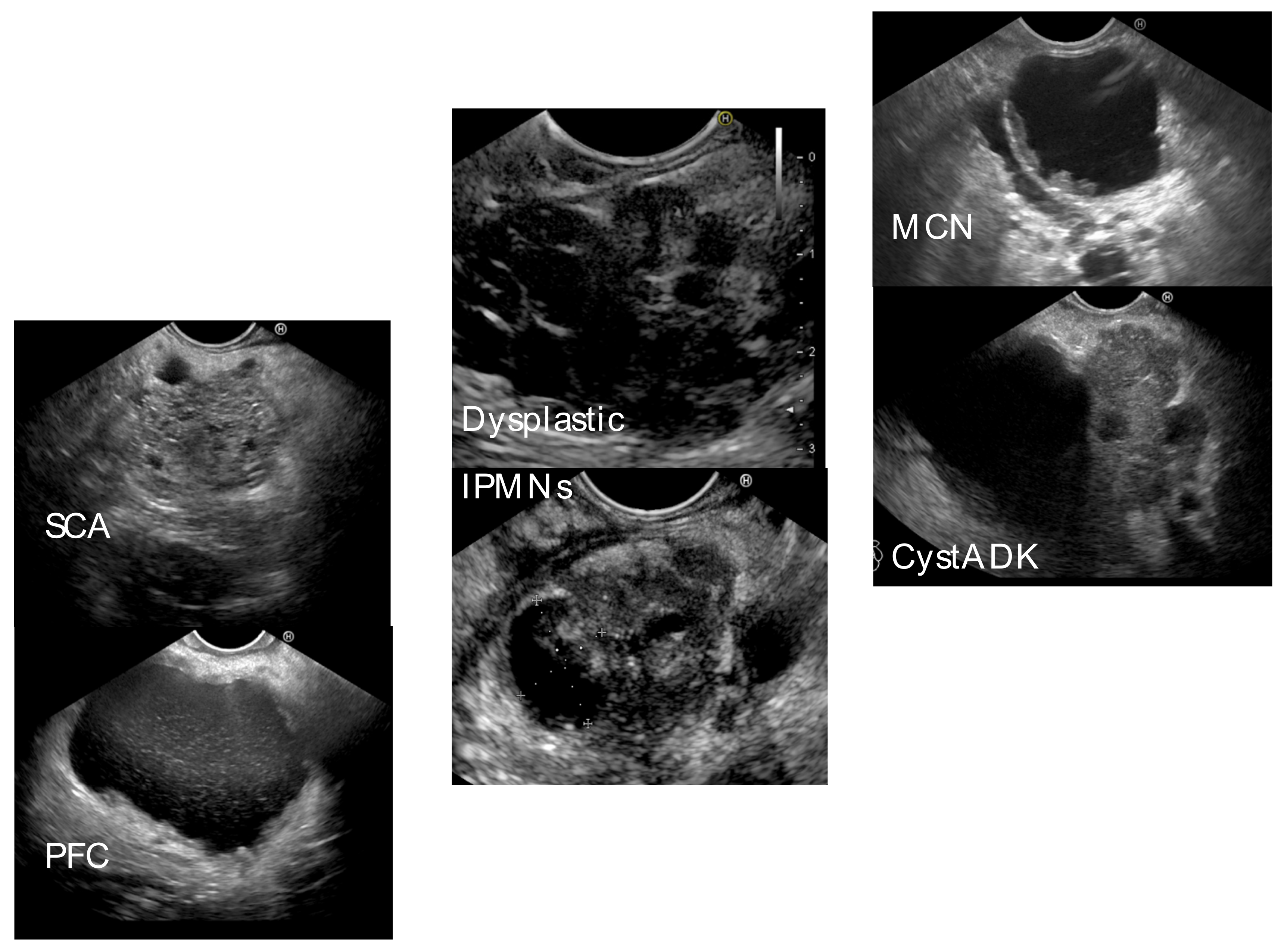 Gastroent 14 00015 g004