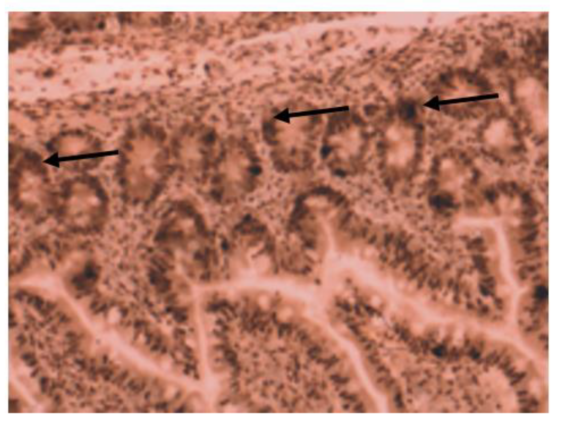 Gastroent 14 00025 g003