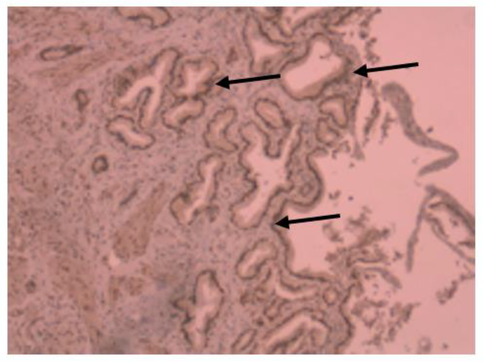 Gastroent 14 00025 g004