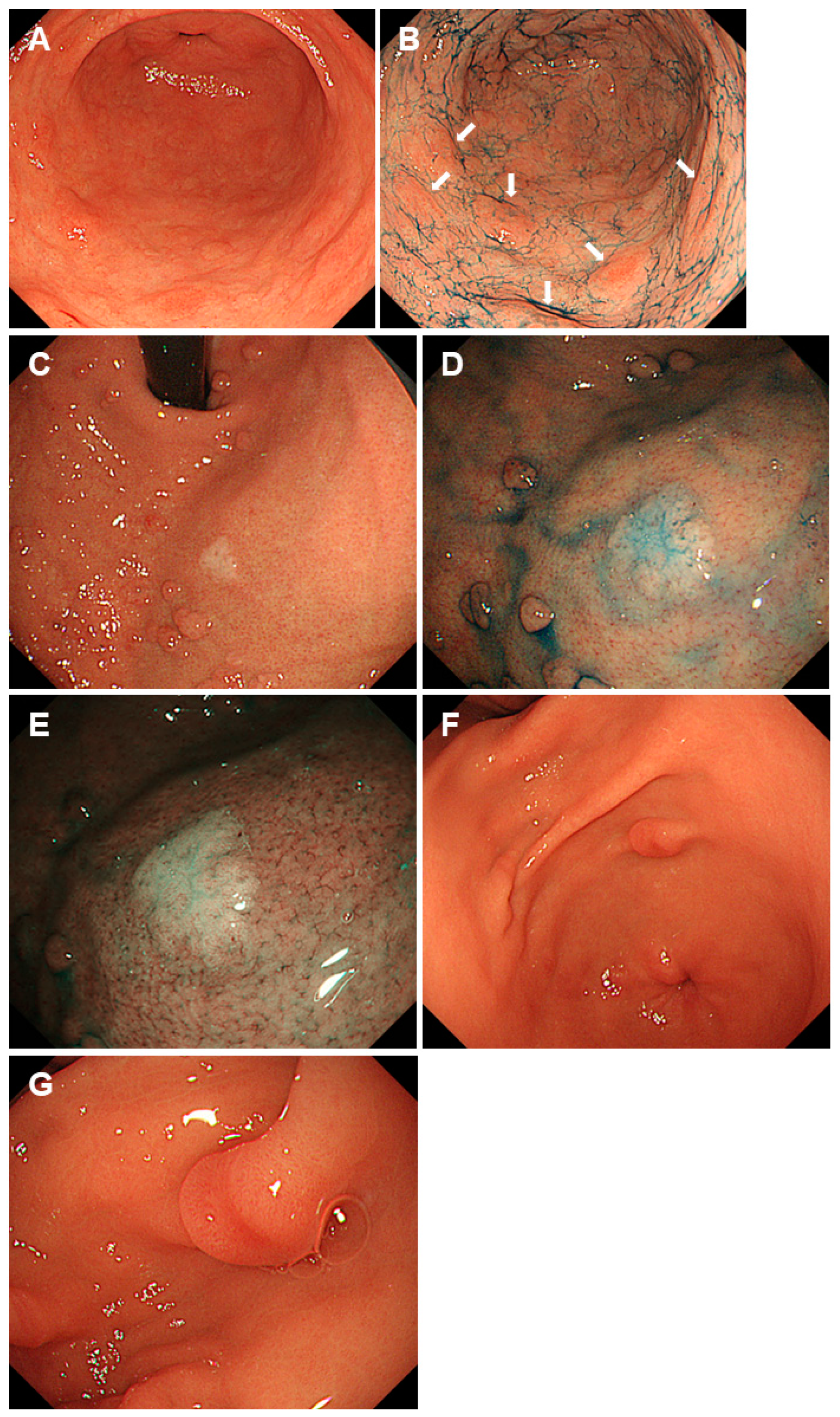 Gastroent 15 00009 g002