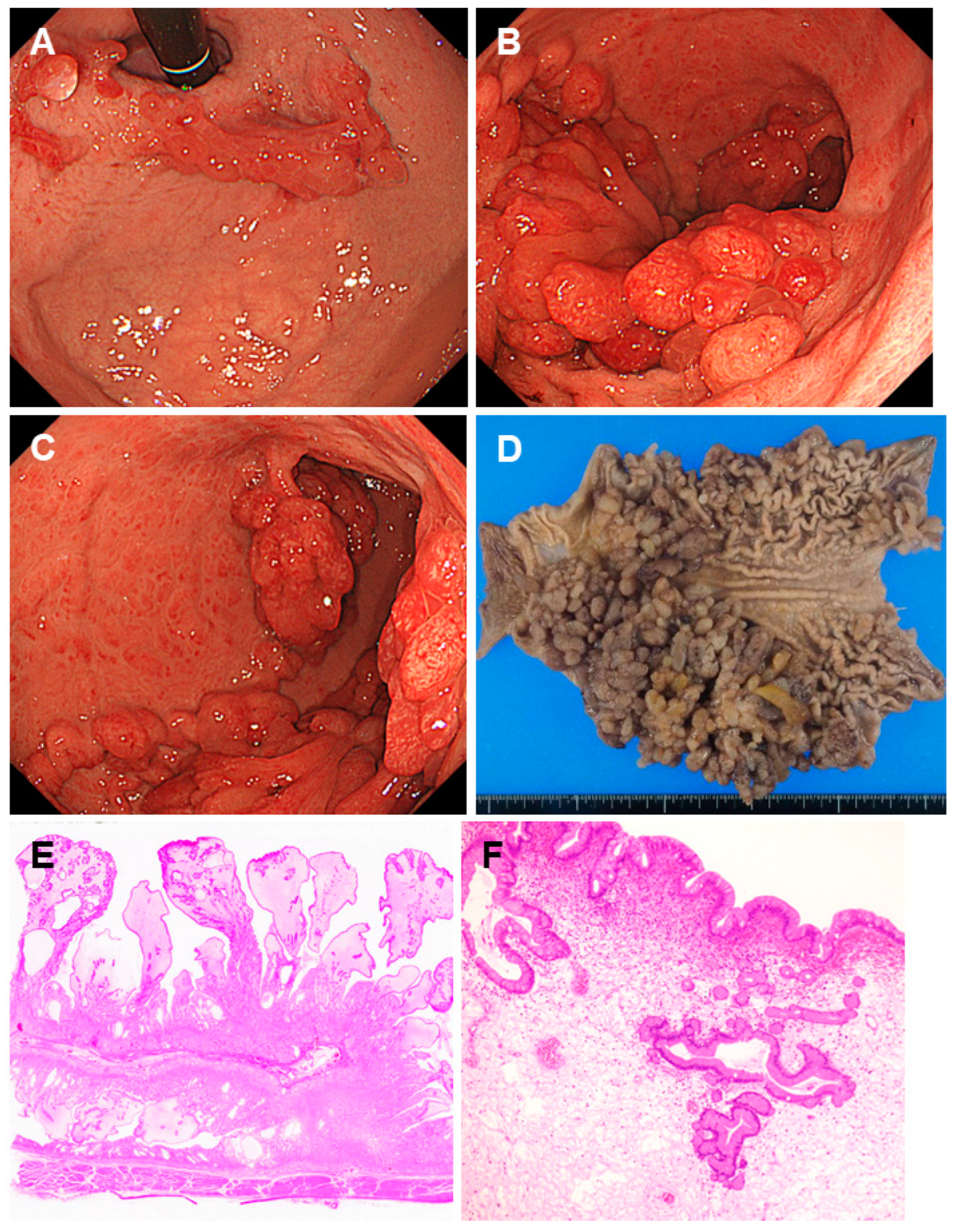 Gastroent 15 00009 g008