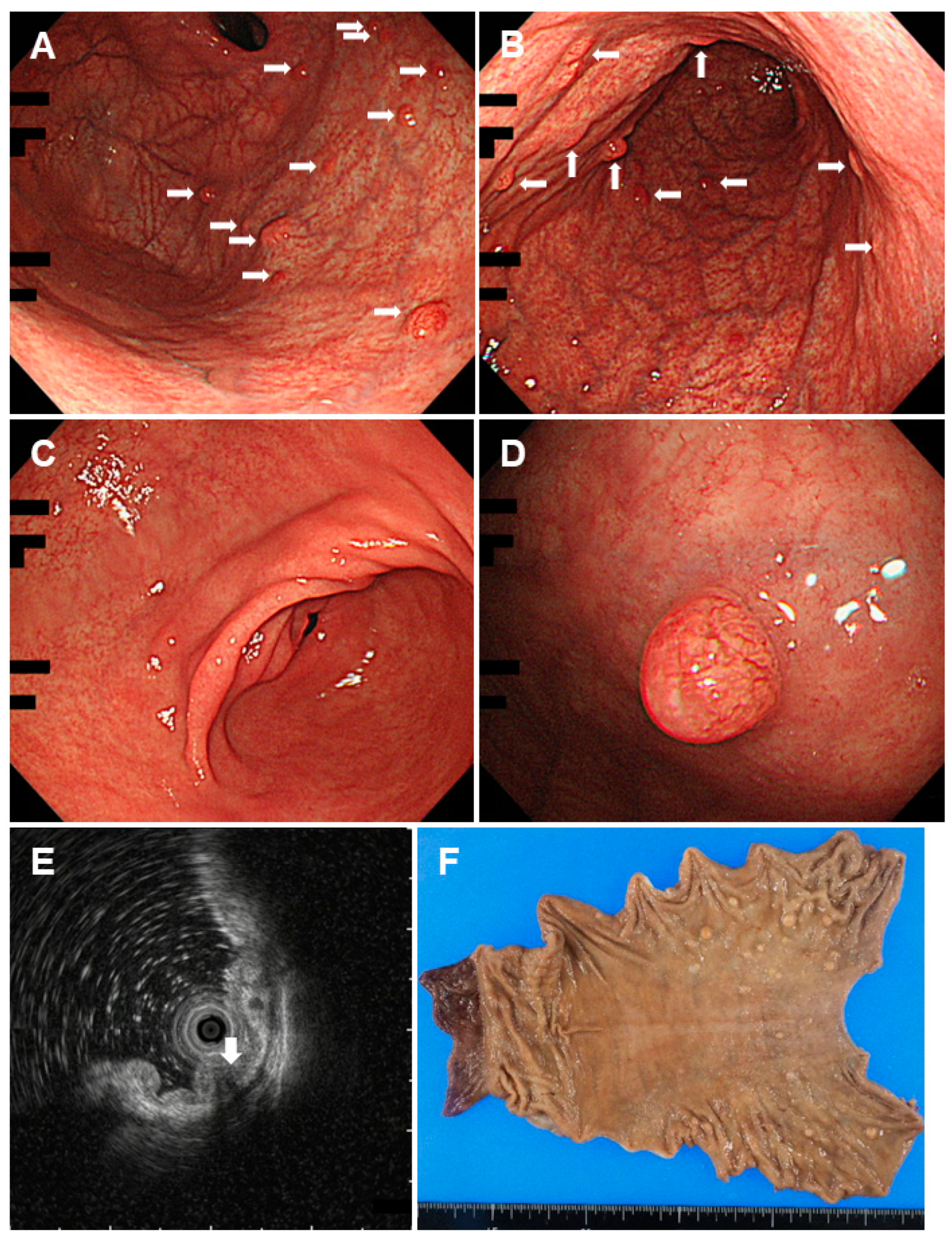 Gastroent 15 00009 g010