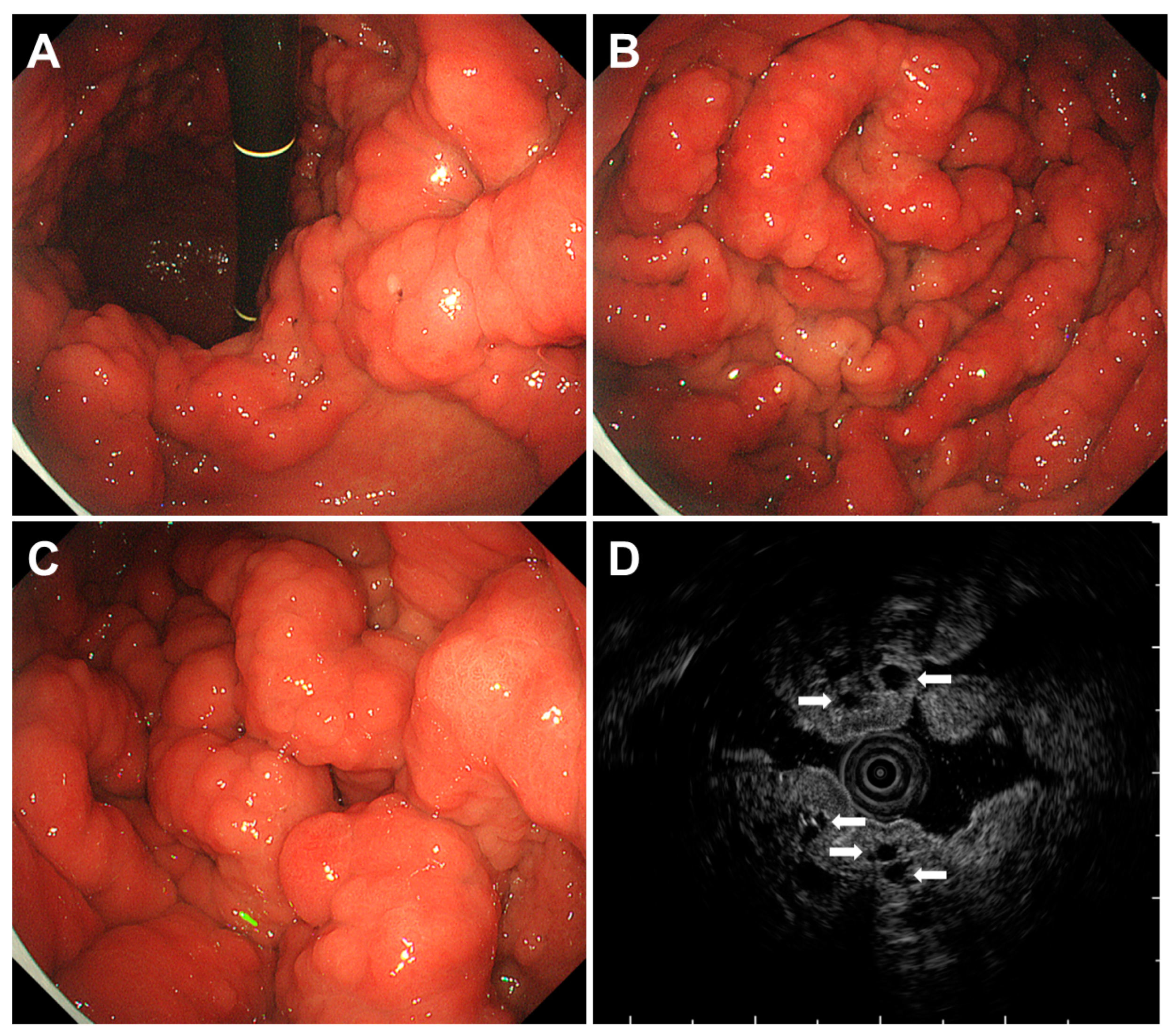 Gastroent 15 00009 g012