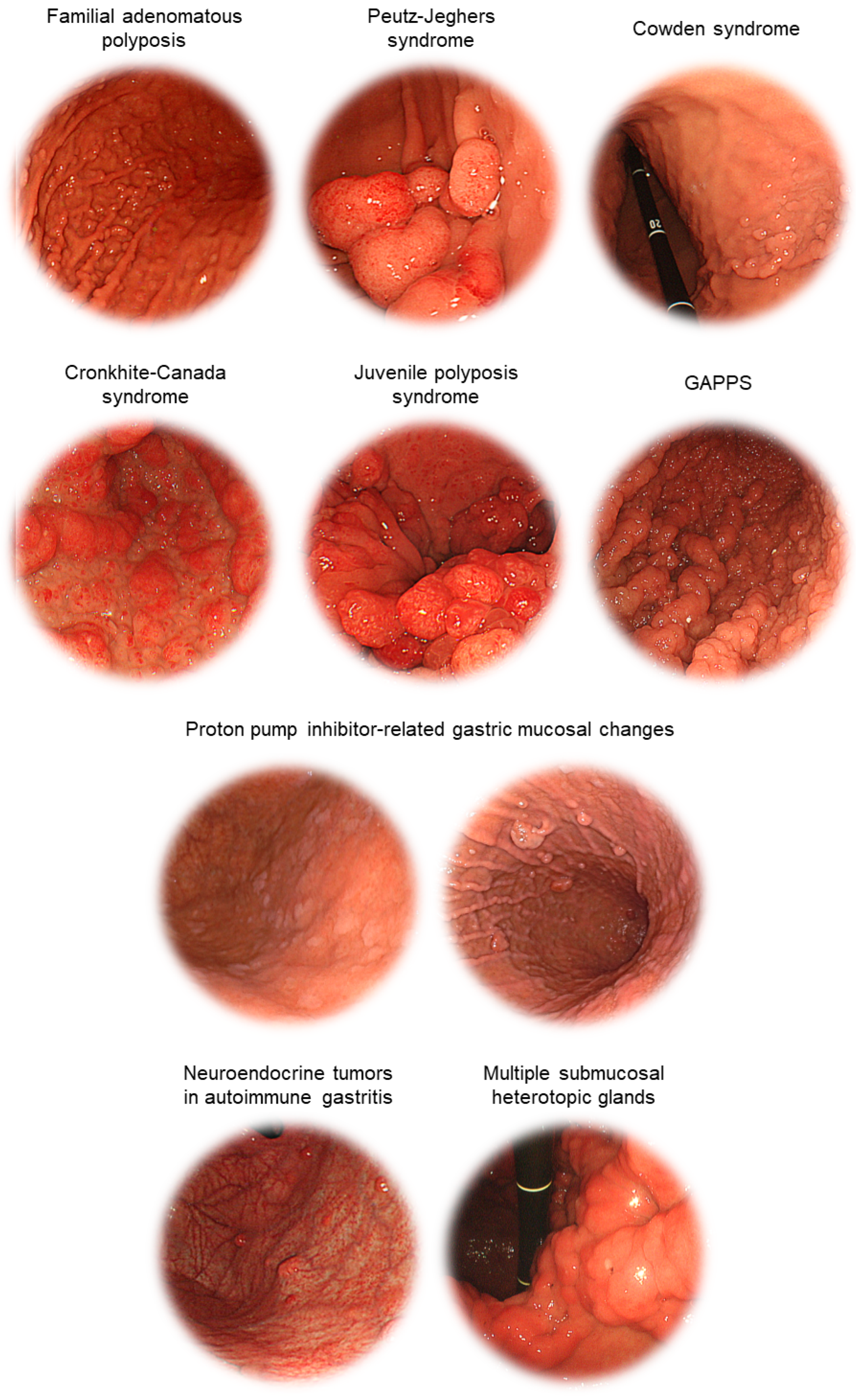 Gastroent 15 00009 g013