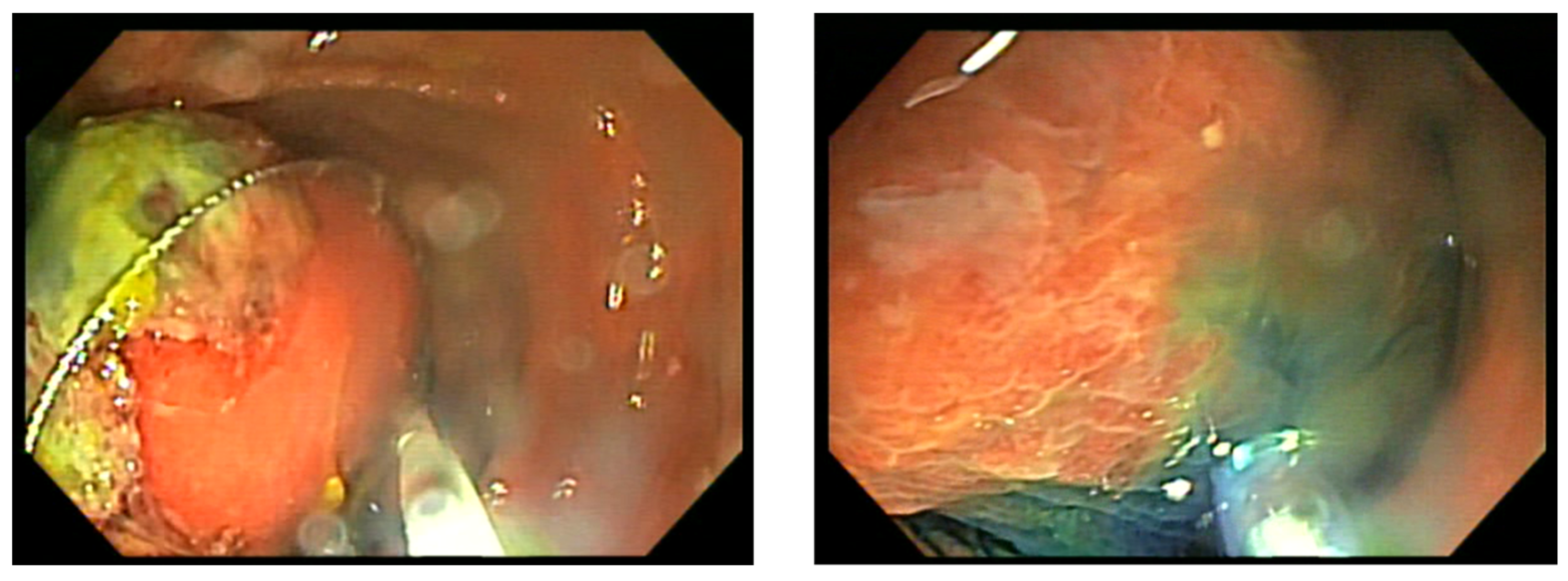 Gastroent 15 00015 g002