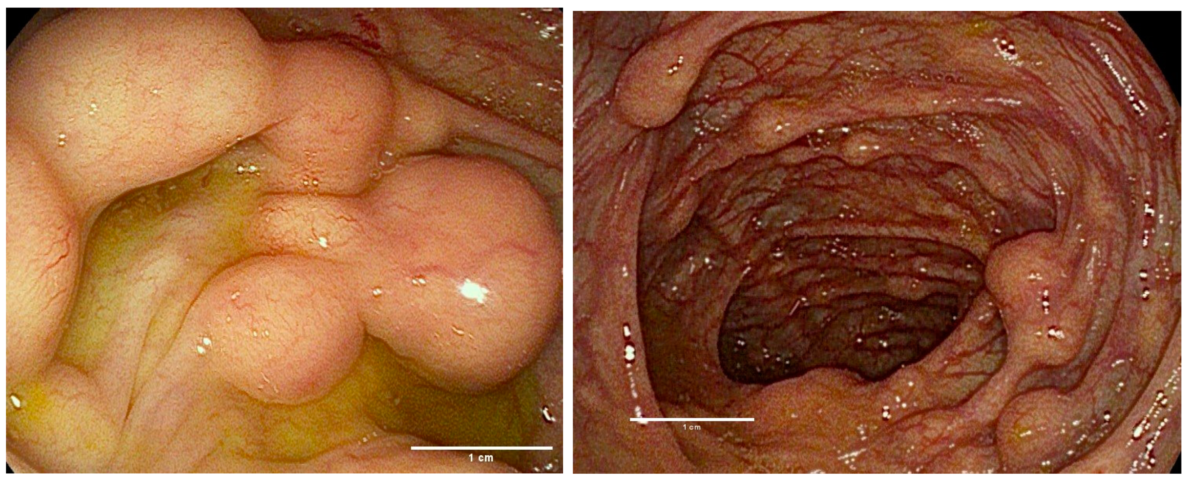 Gastroent 15 00018 g002