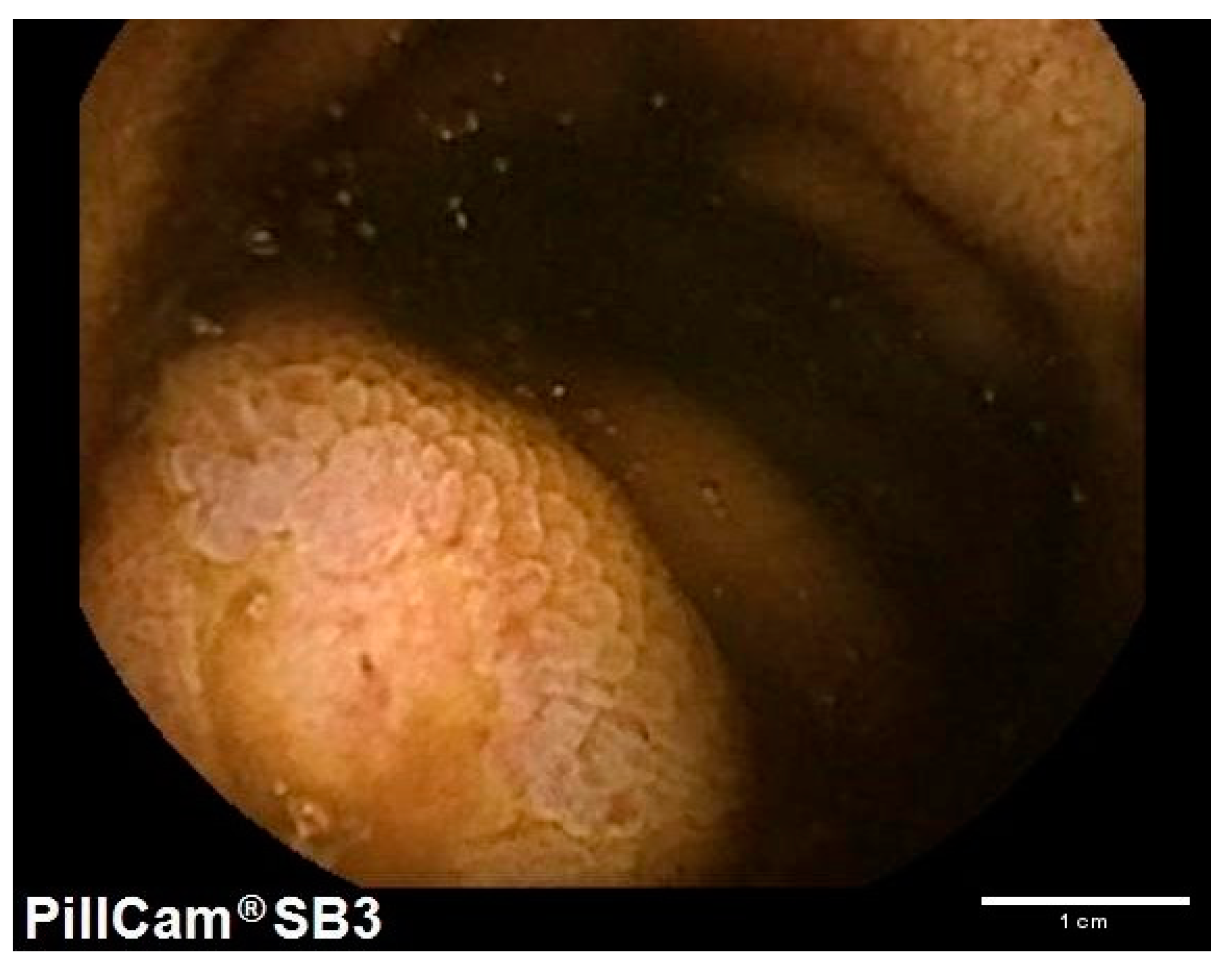 Gastroent 15 00018 g003