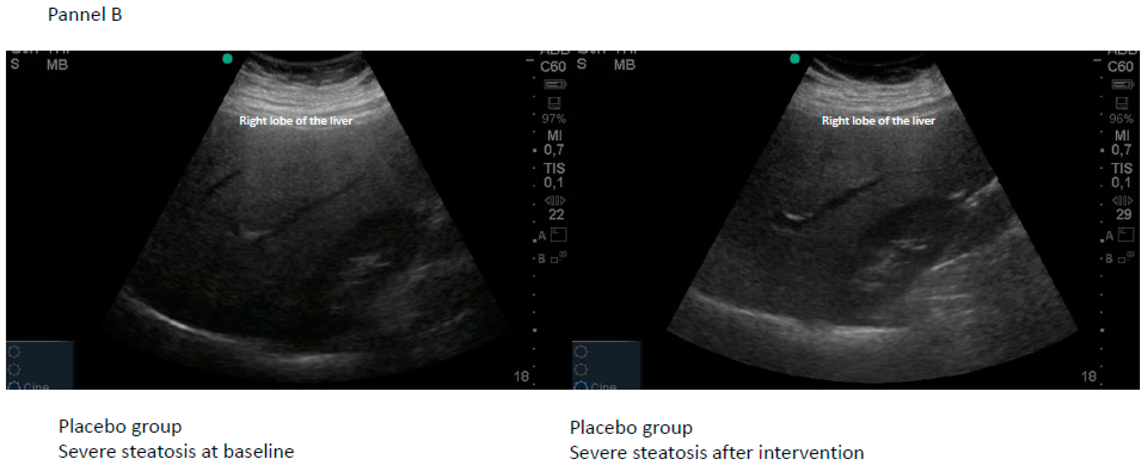 Gastroent 15 00024 g004b
