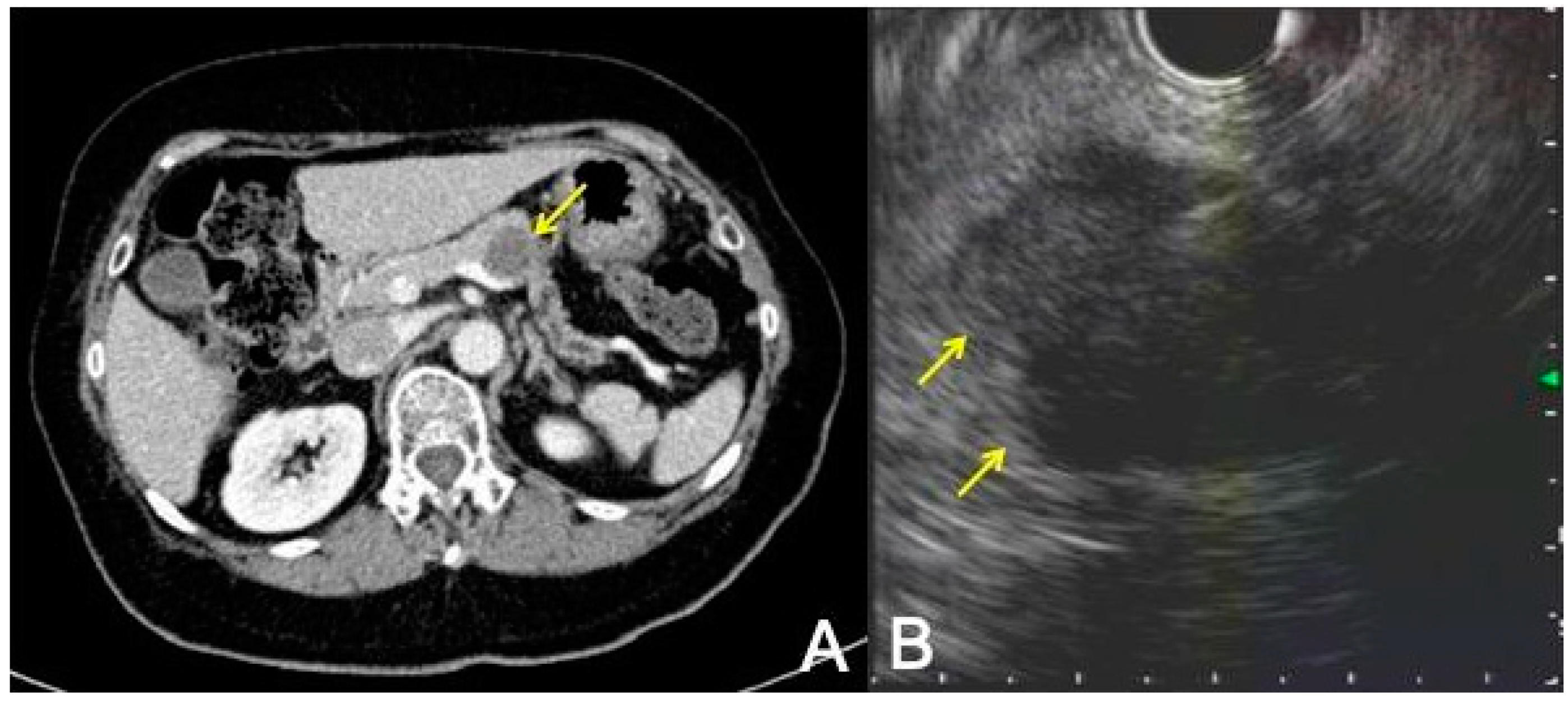 Gastroent 15 00026 g002