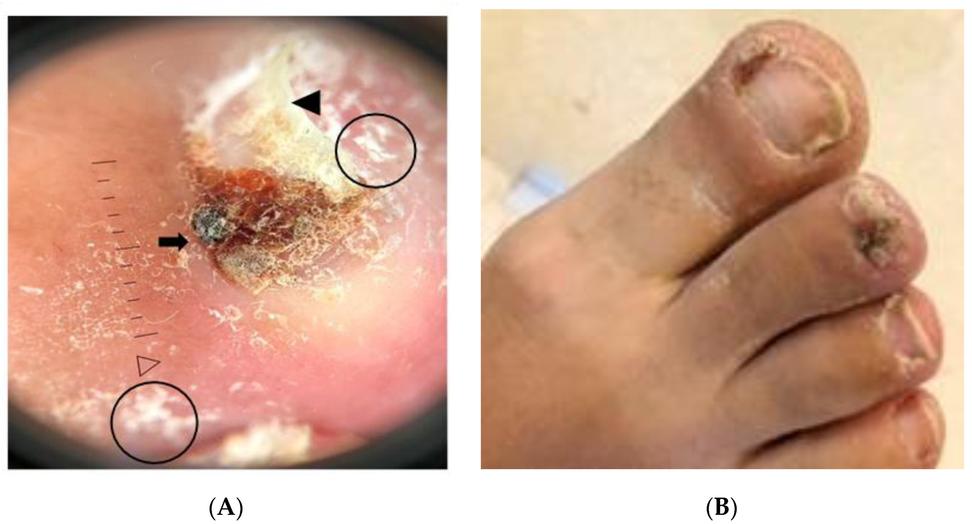 Gastroent 15 00037 g005 Gastroent 15 00037 g005