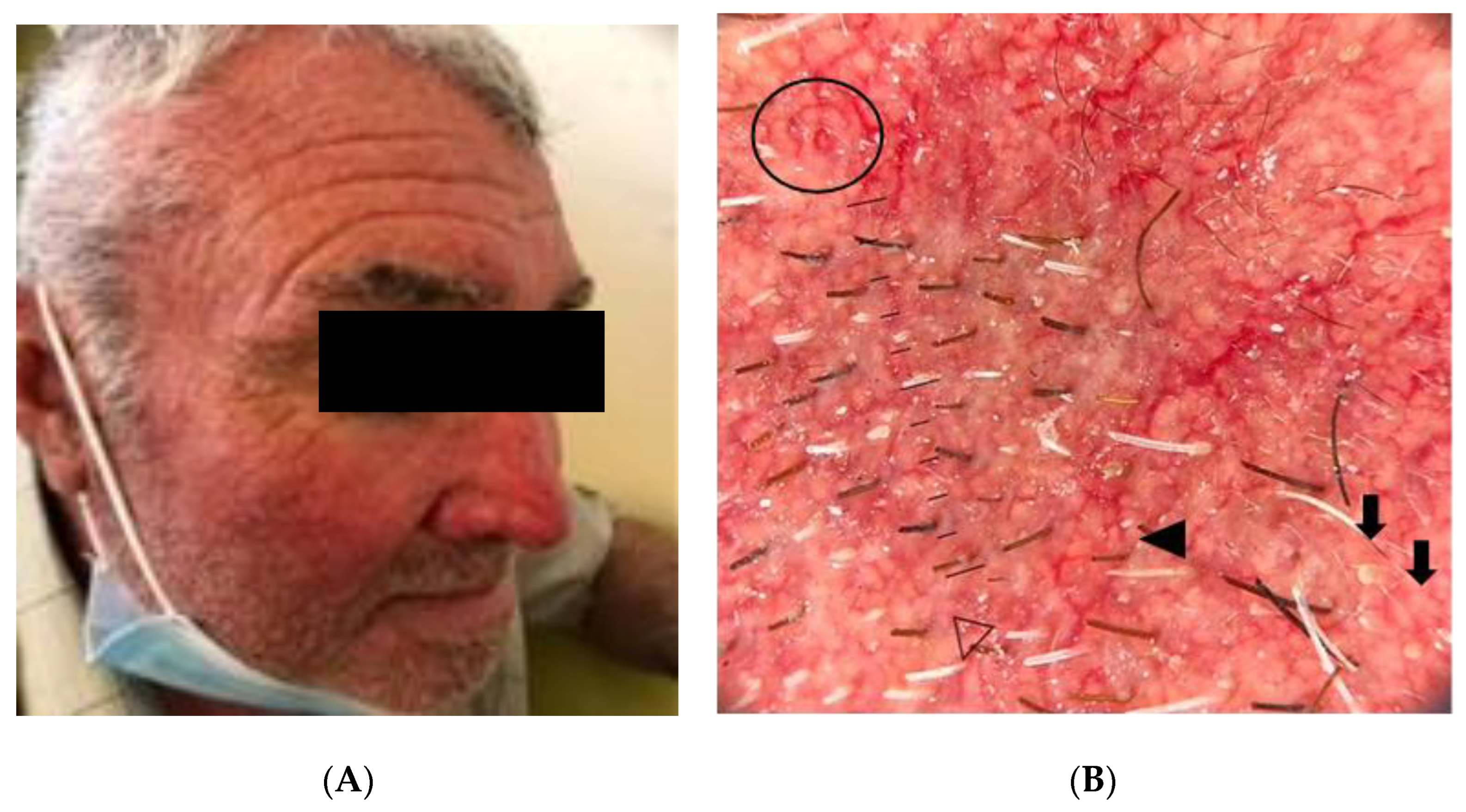 Gastroent 15 00037 g006 Gastroent 15 00037 g006