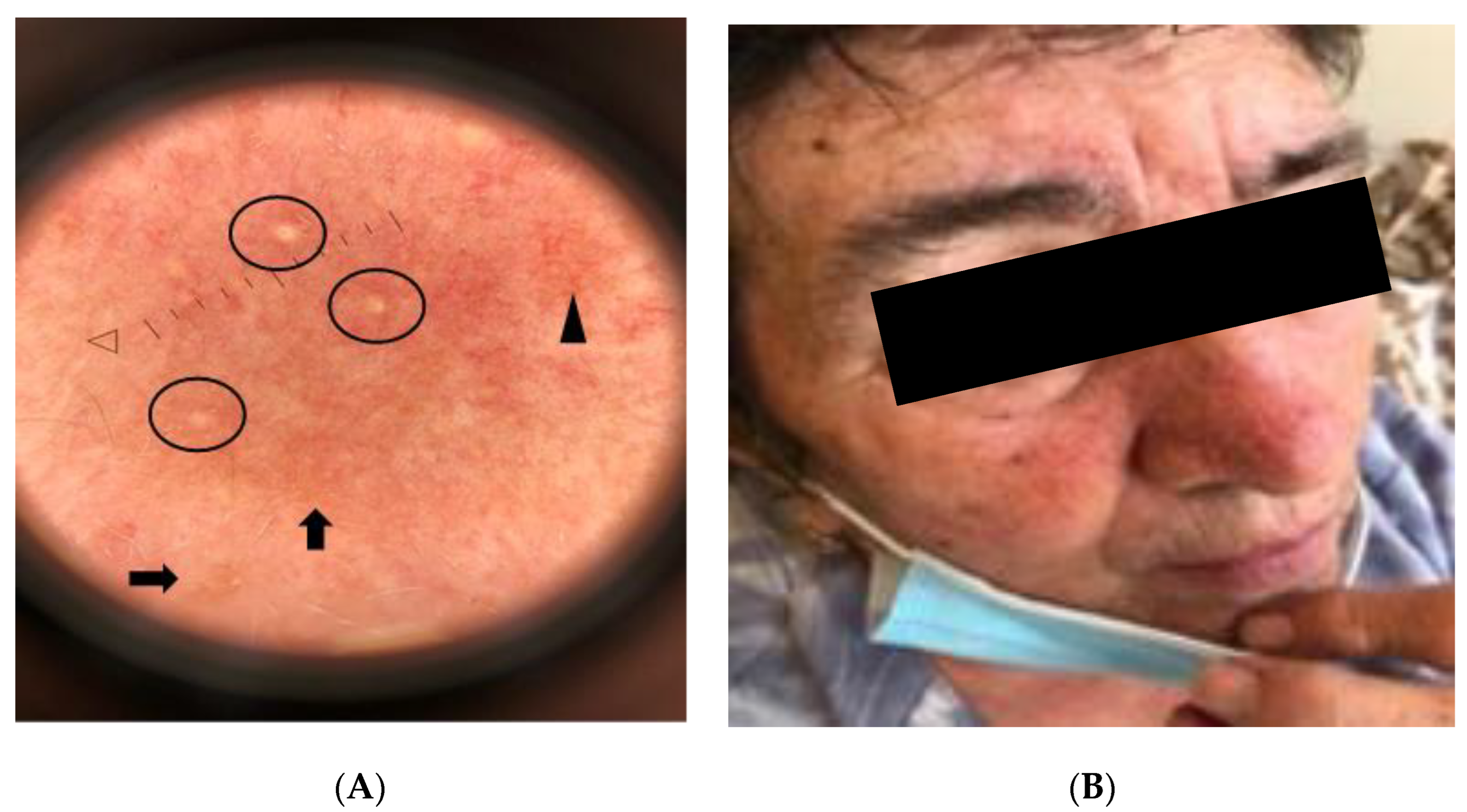 Gastroent 15 00037 g007 Gastroent 15 00037 g007