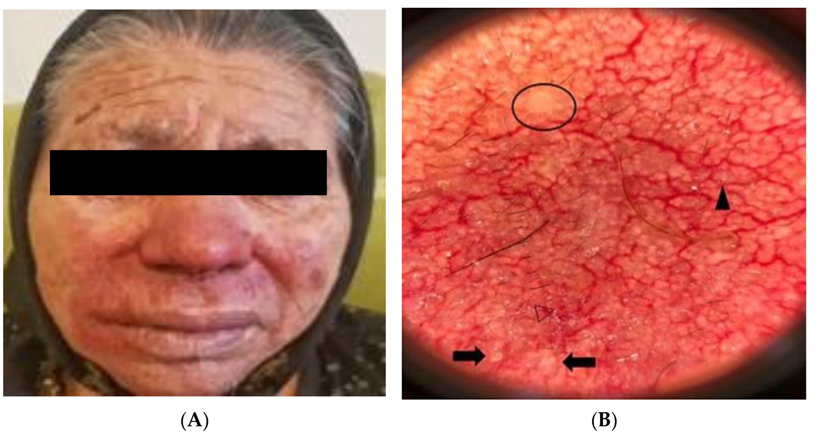 Gastroent 15 00037 g008 Gastroent 15 00037 g008