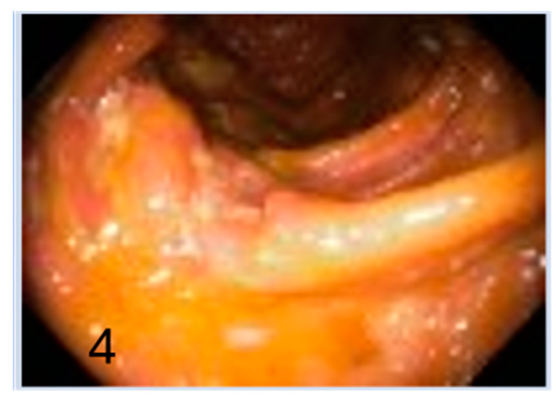 Gastroent 15 00040 g004 Gastroent 15 00040 g004