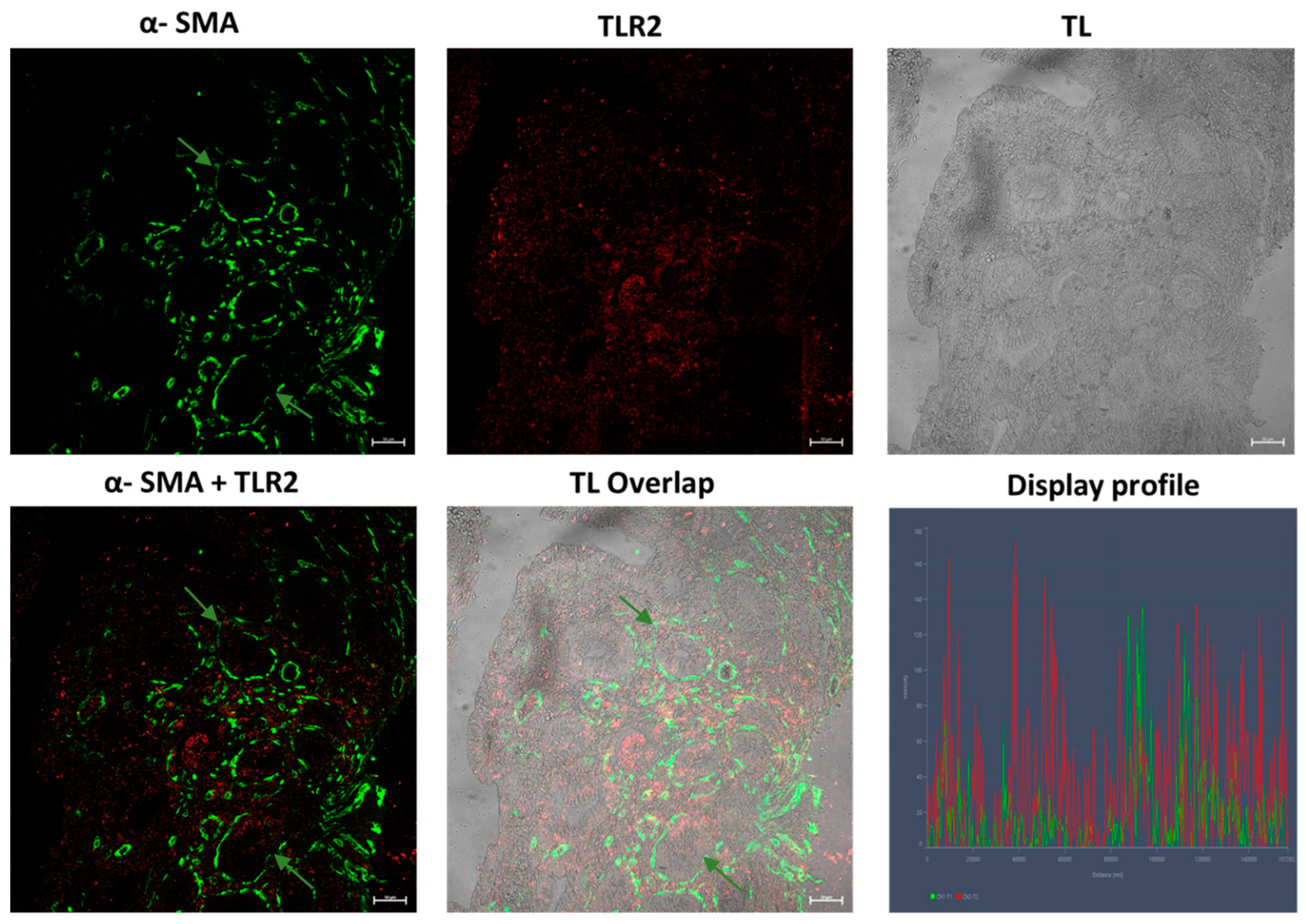Gastroent 15 00040 g009 Gastroent 15 00040 g009