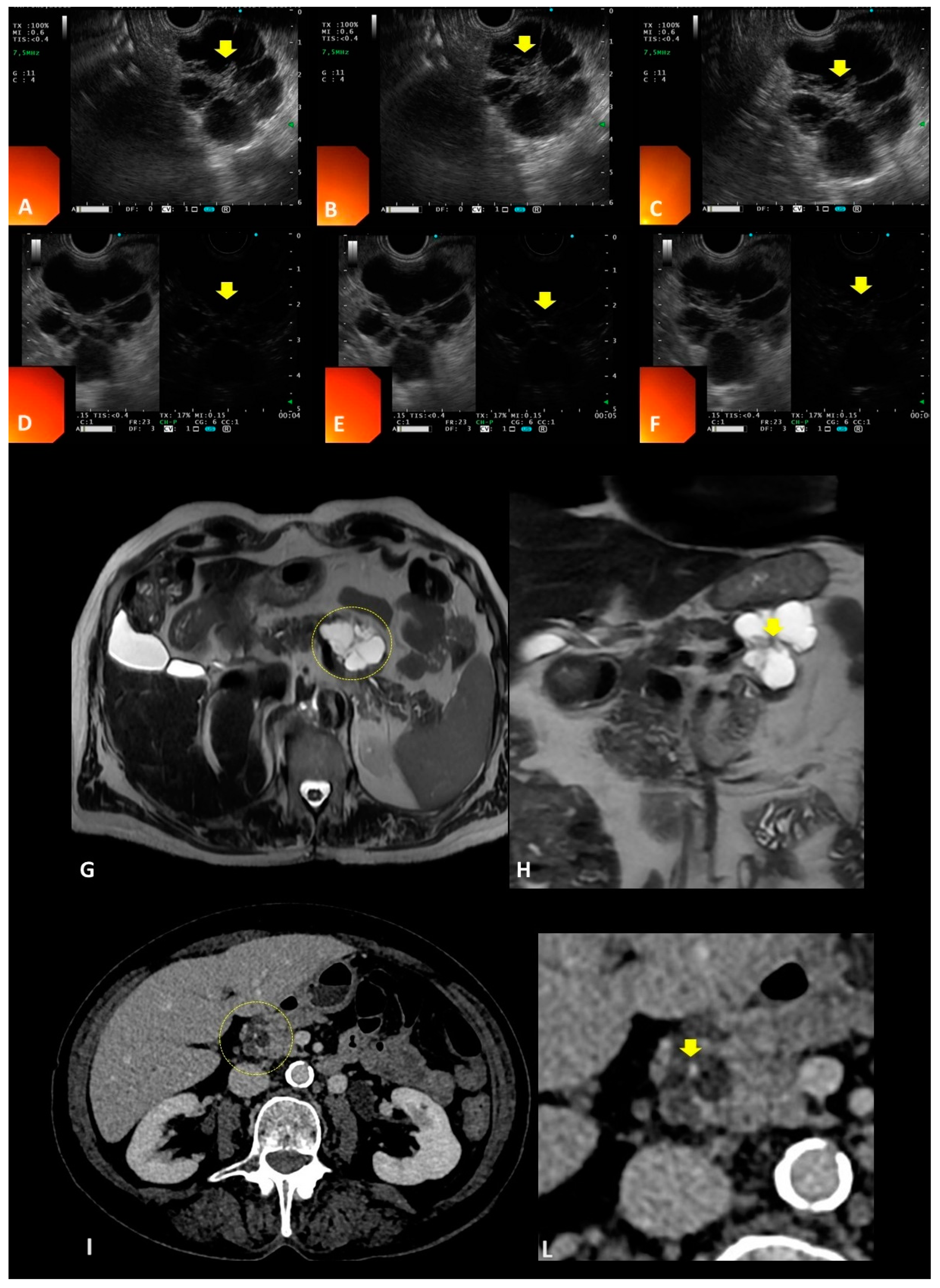 Gastroent 15 00057 g001