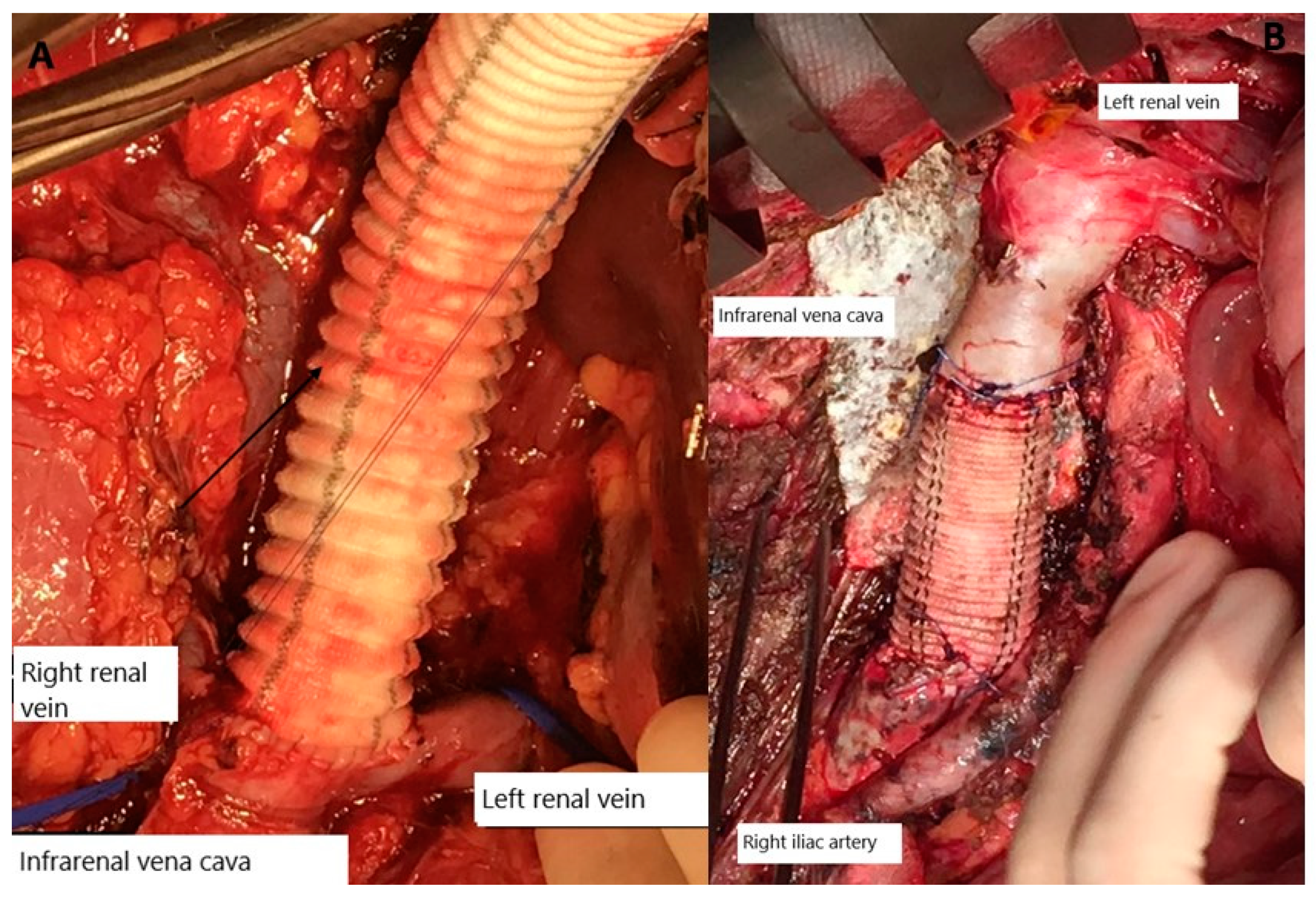 Gastroent 15 00060 g002
