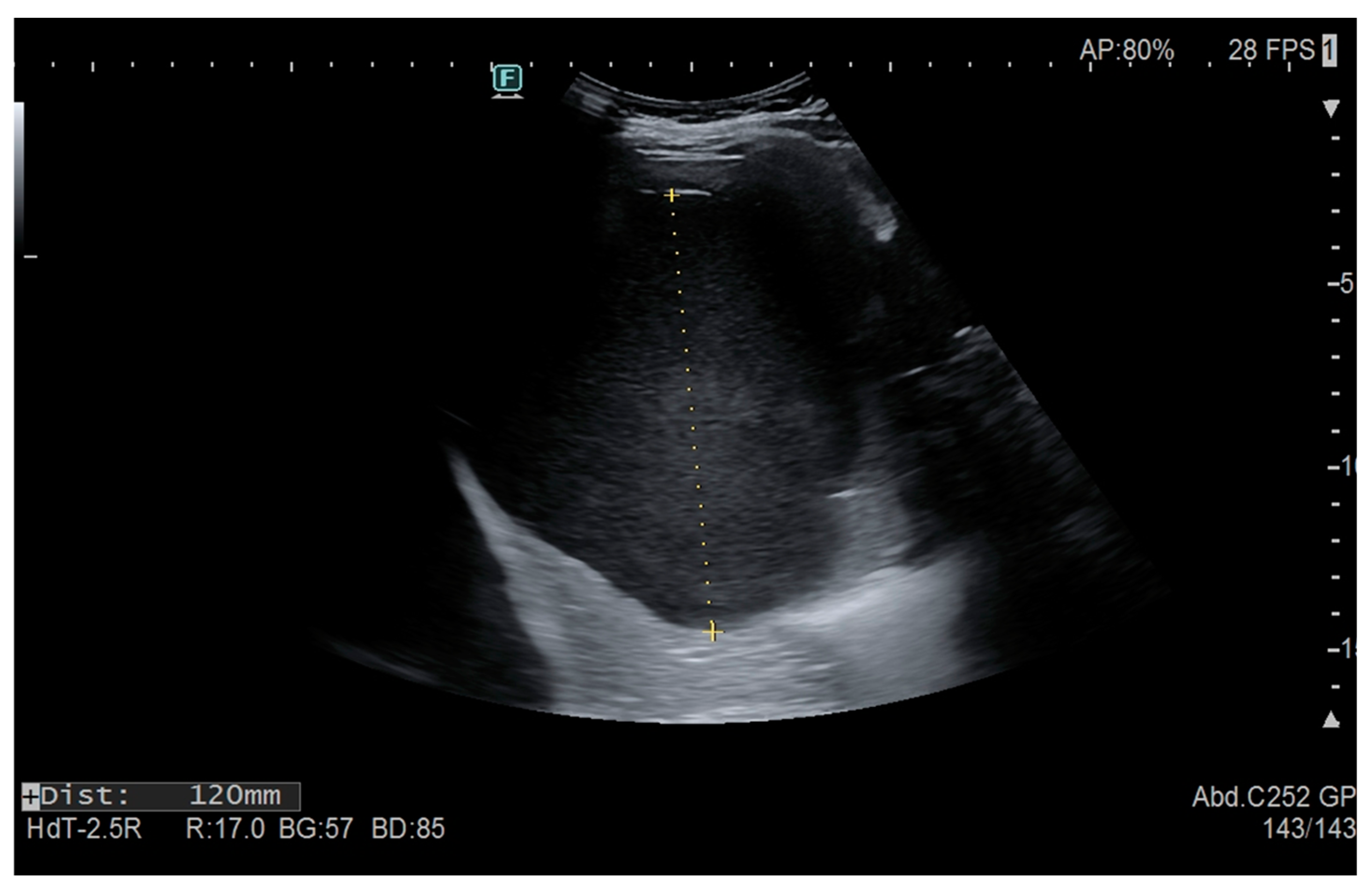 Gastroent 15 00063 g001 Gastroent 15 00063 g001