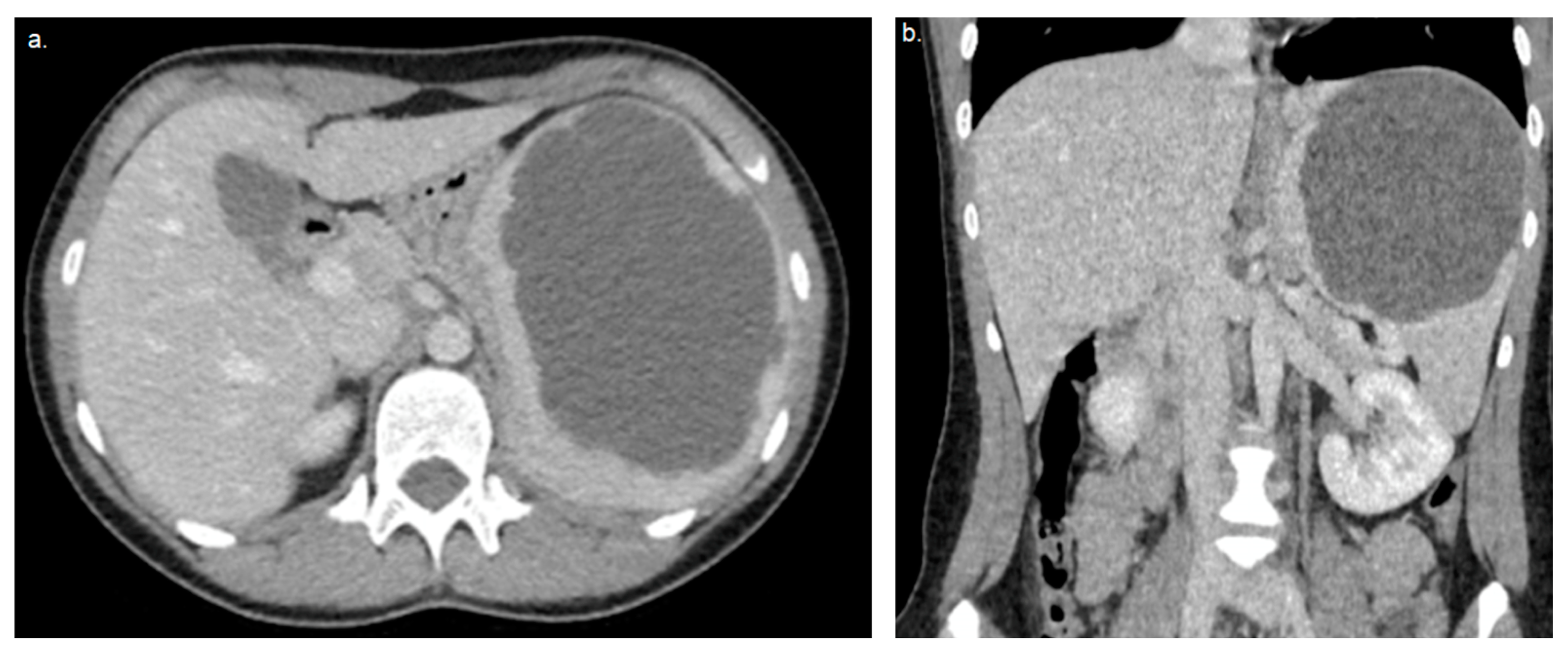 Gastroent 15 00063 g002 Gastroent 15 00063 g002