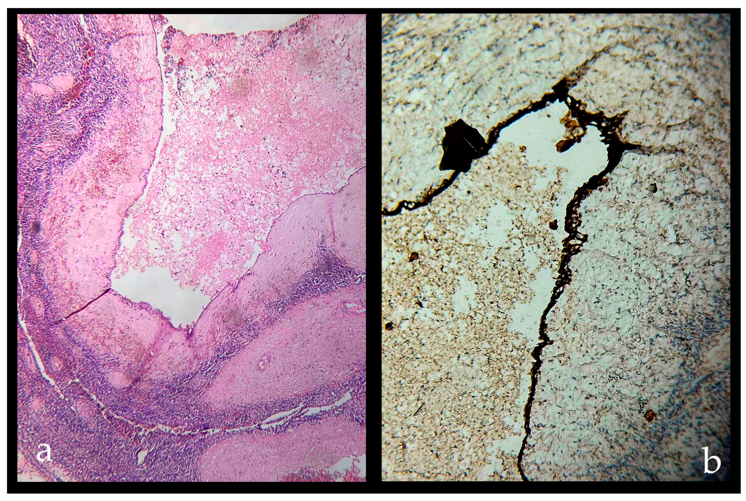 Gastroent 15 00063 g003 Gastroent 15 00063 g003