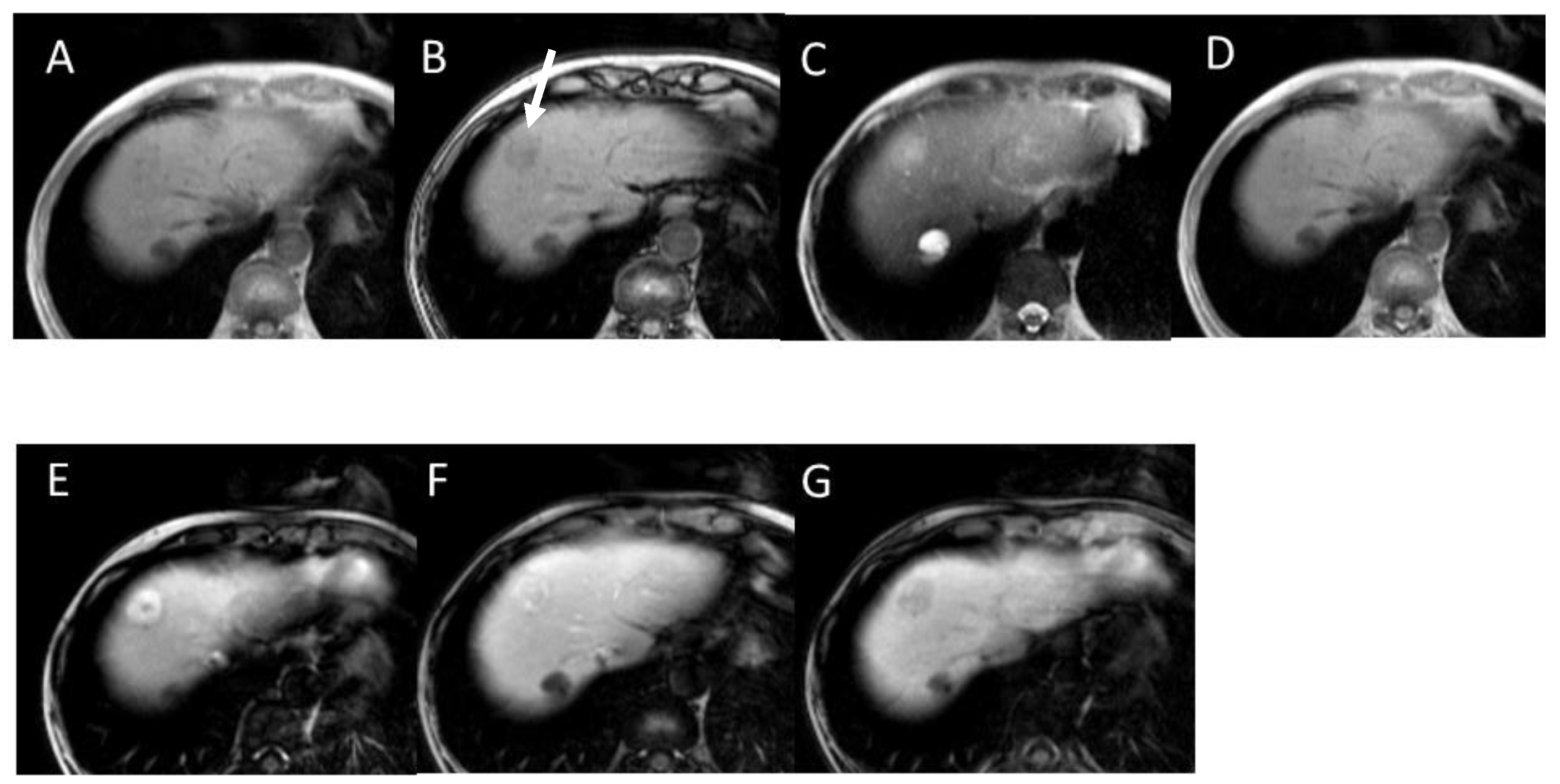 Gastroent 15 00068 g004