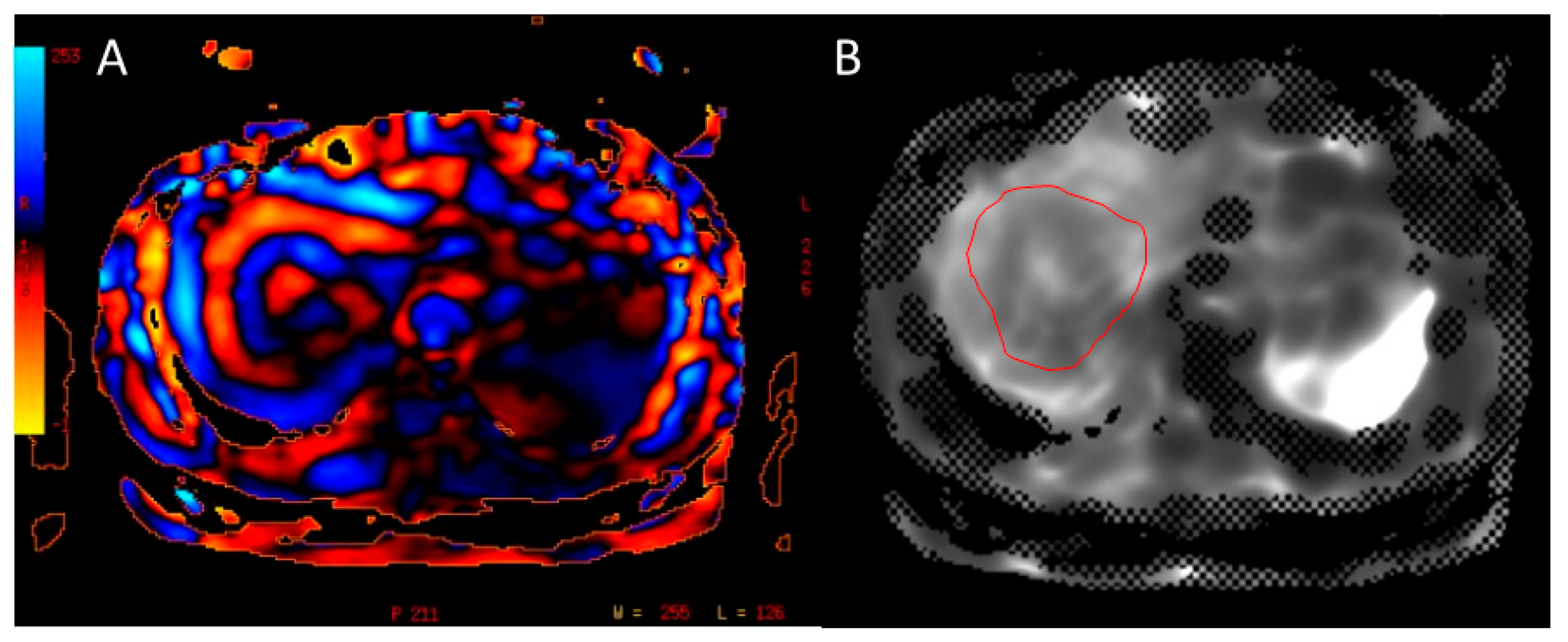 Gastroent 15 00068 g006