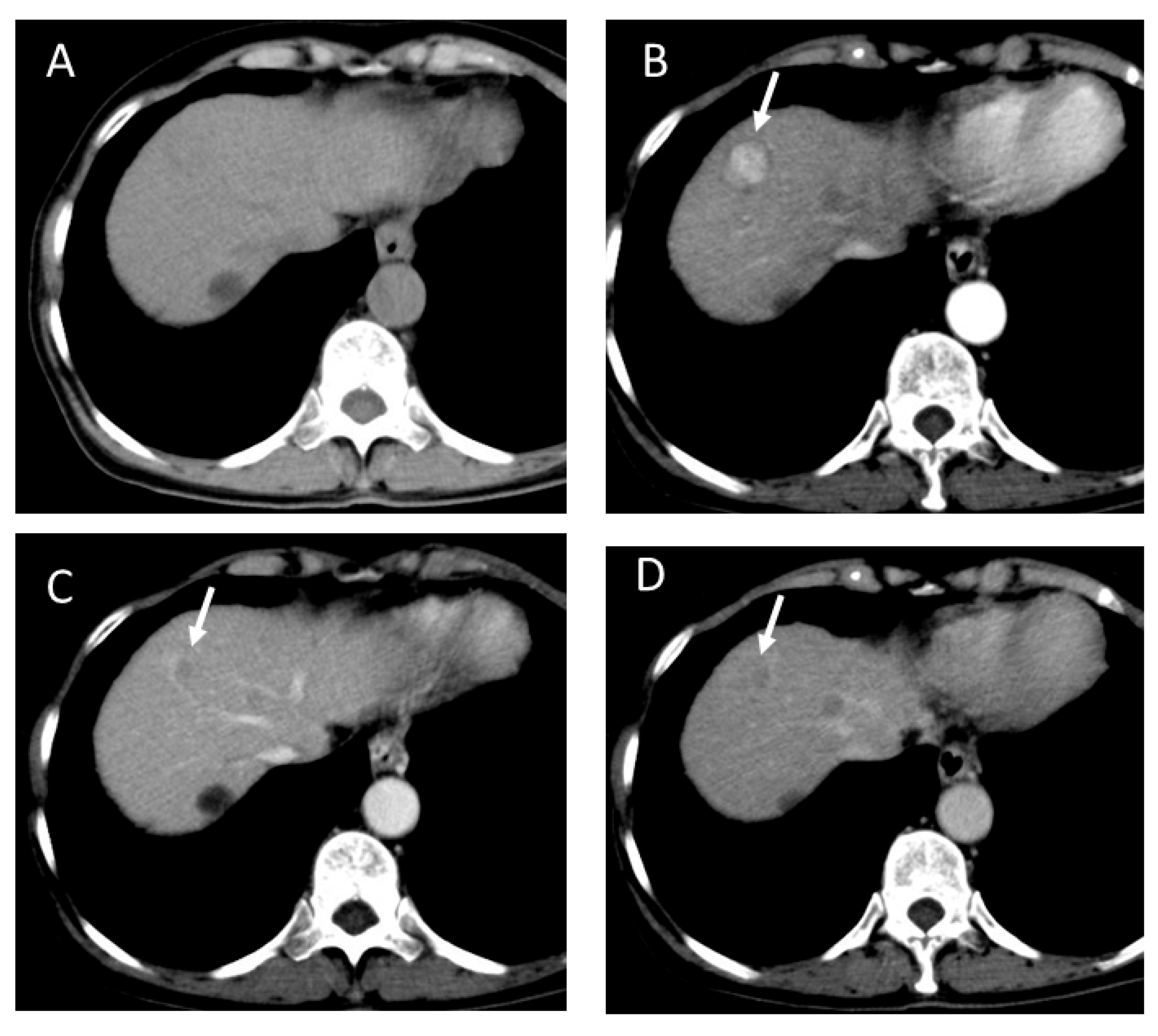Gastroent 15 00068 g012