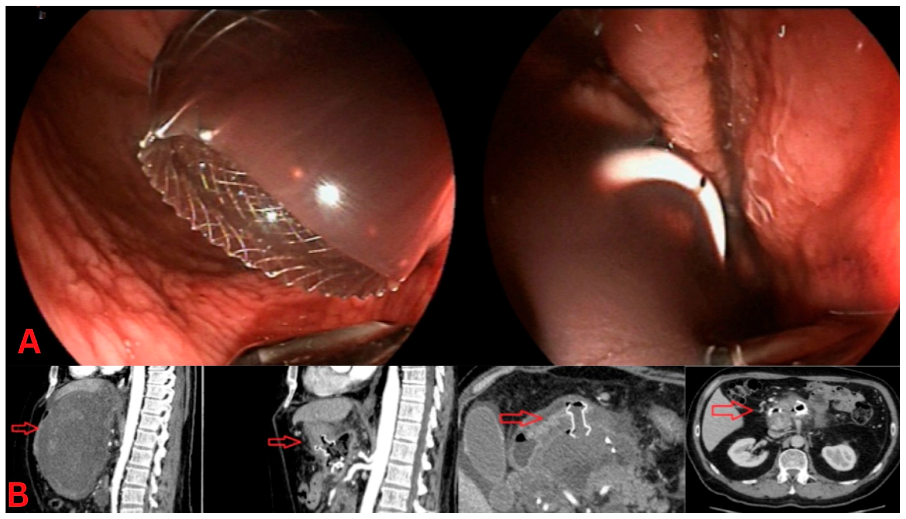 Gastroent 16 00027 g002