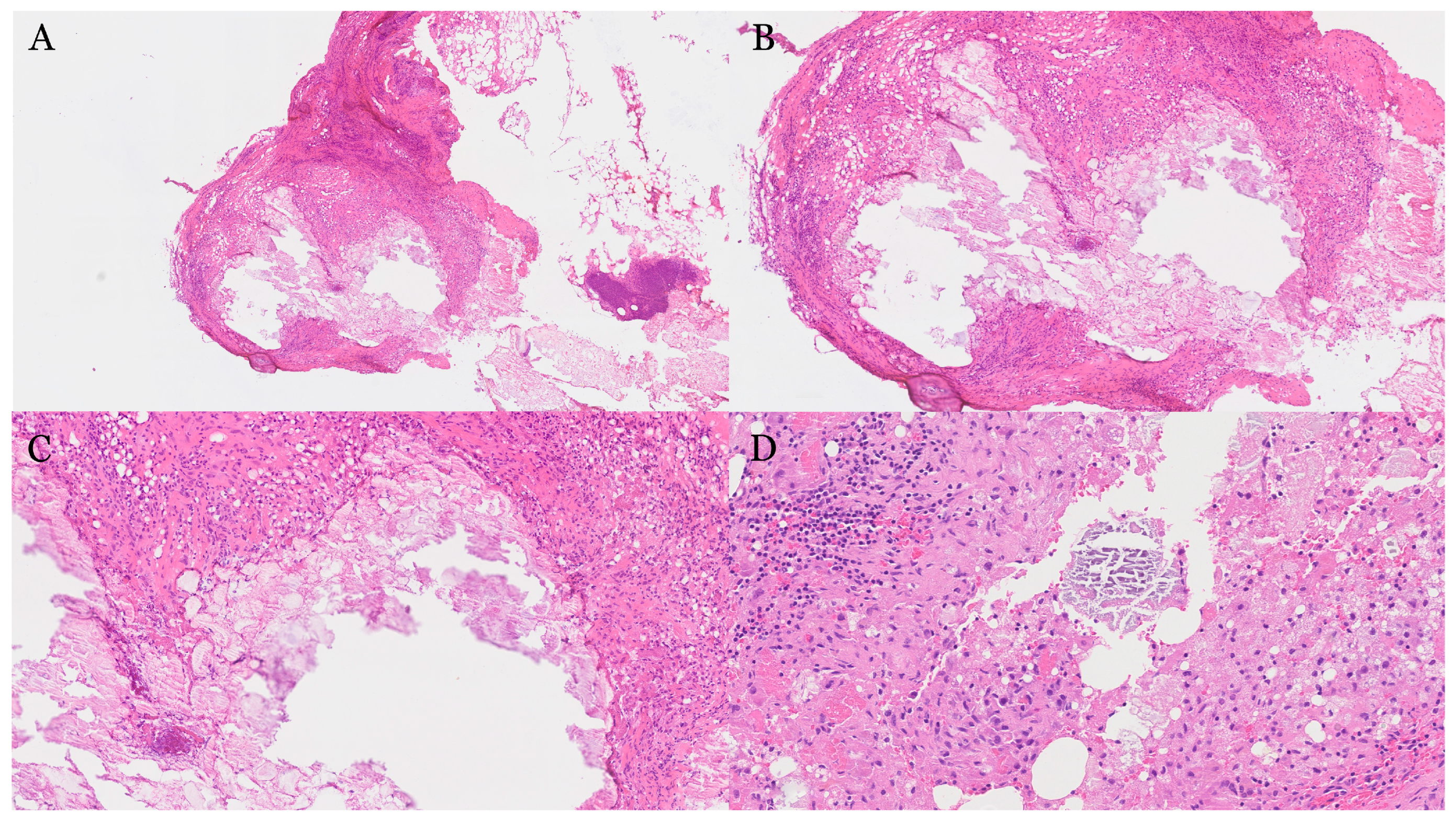 Gastroent 16 00046 g003 Gastroent 16 00046 g003
