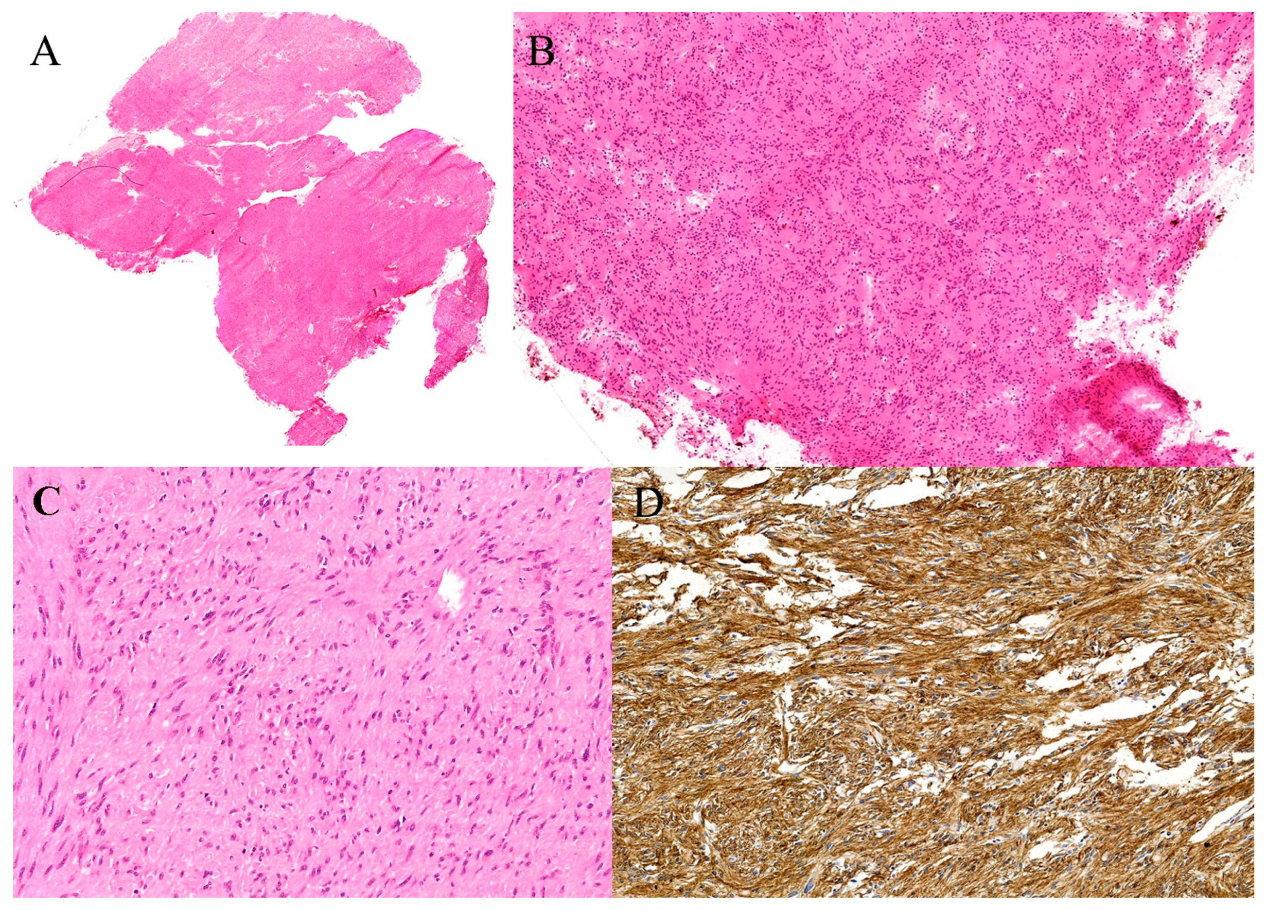 Gastroent 16 00046 g005 Gastroent 16 00046 g005