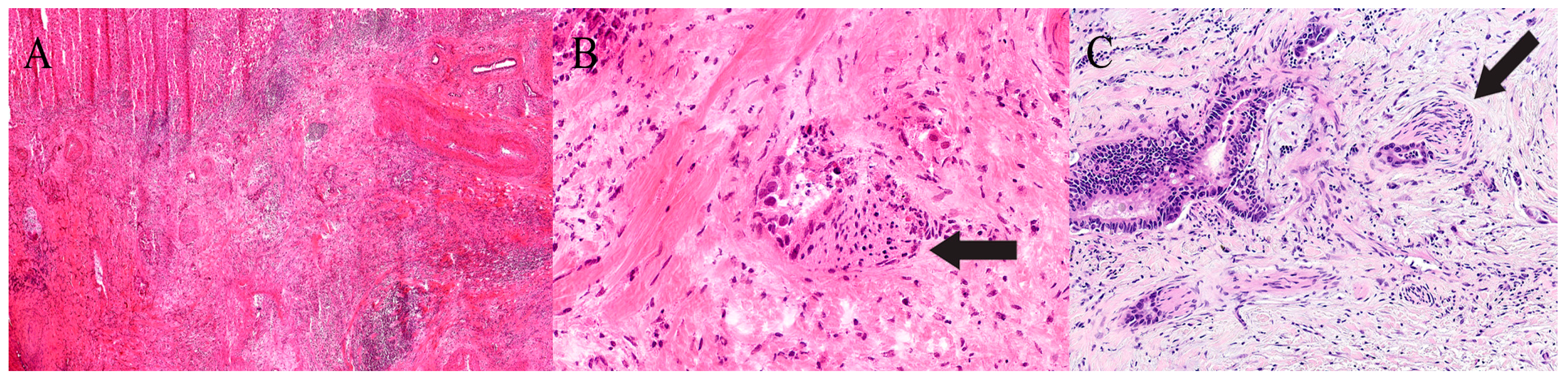 Gastroent 16 00046 g007 Gastroent 16 00046 g007