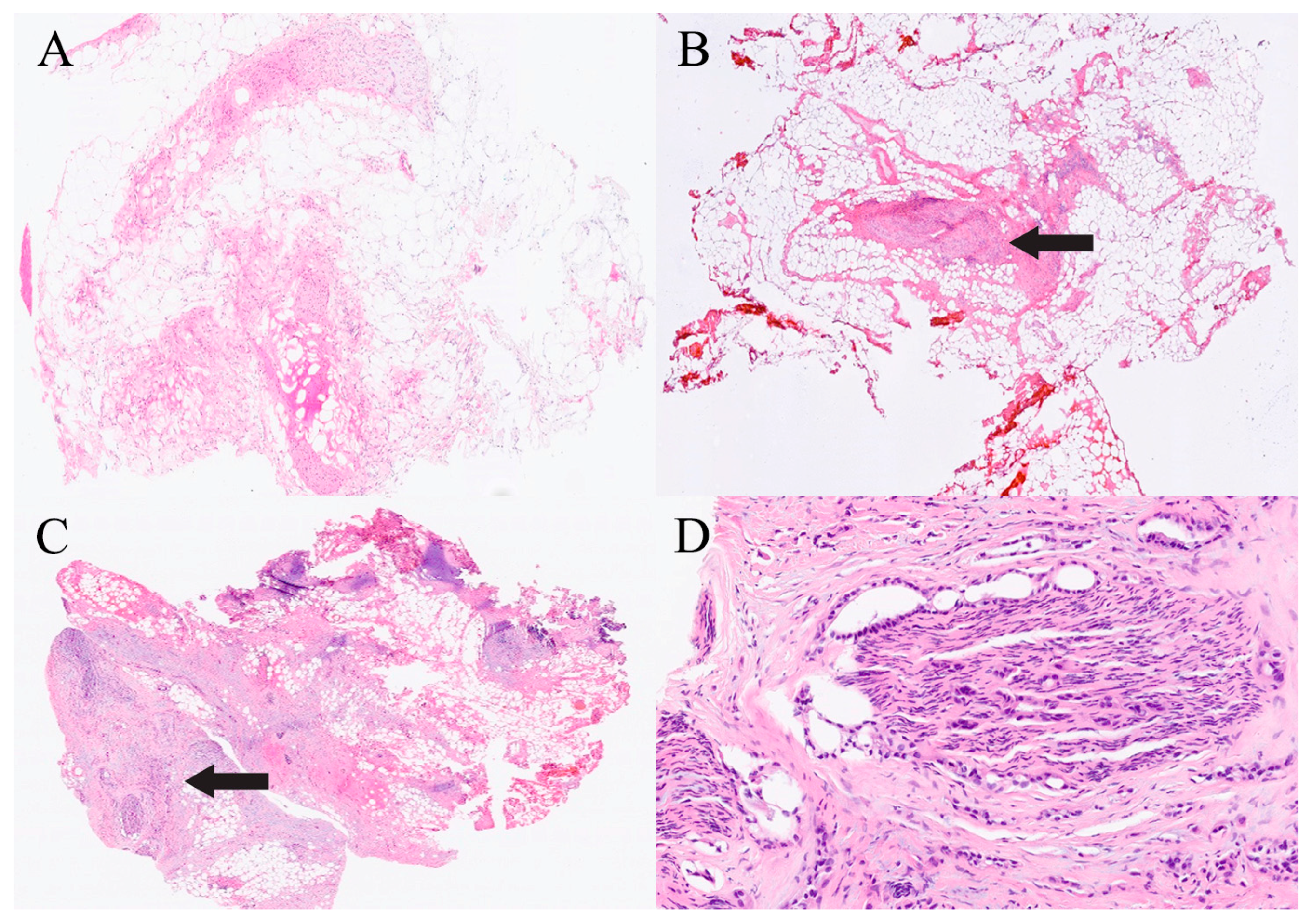 Gastroent 16 00046 g008 Gastroent 16 00046 g008