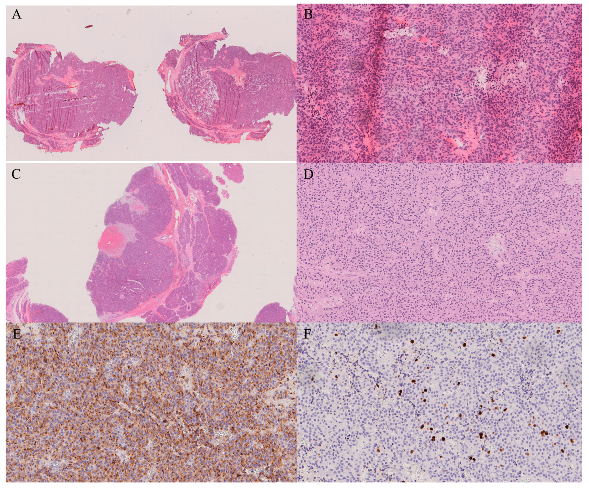Gastroent 16 00046 g009 Gastroent 16 00046 g009