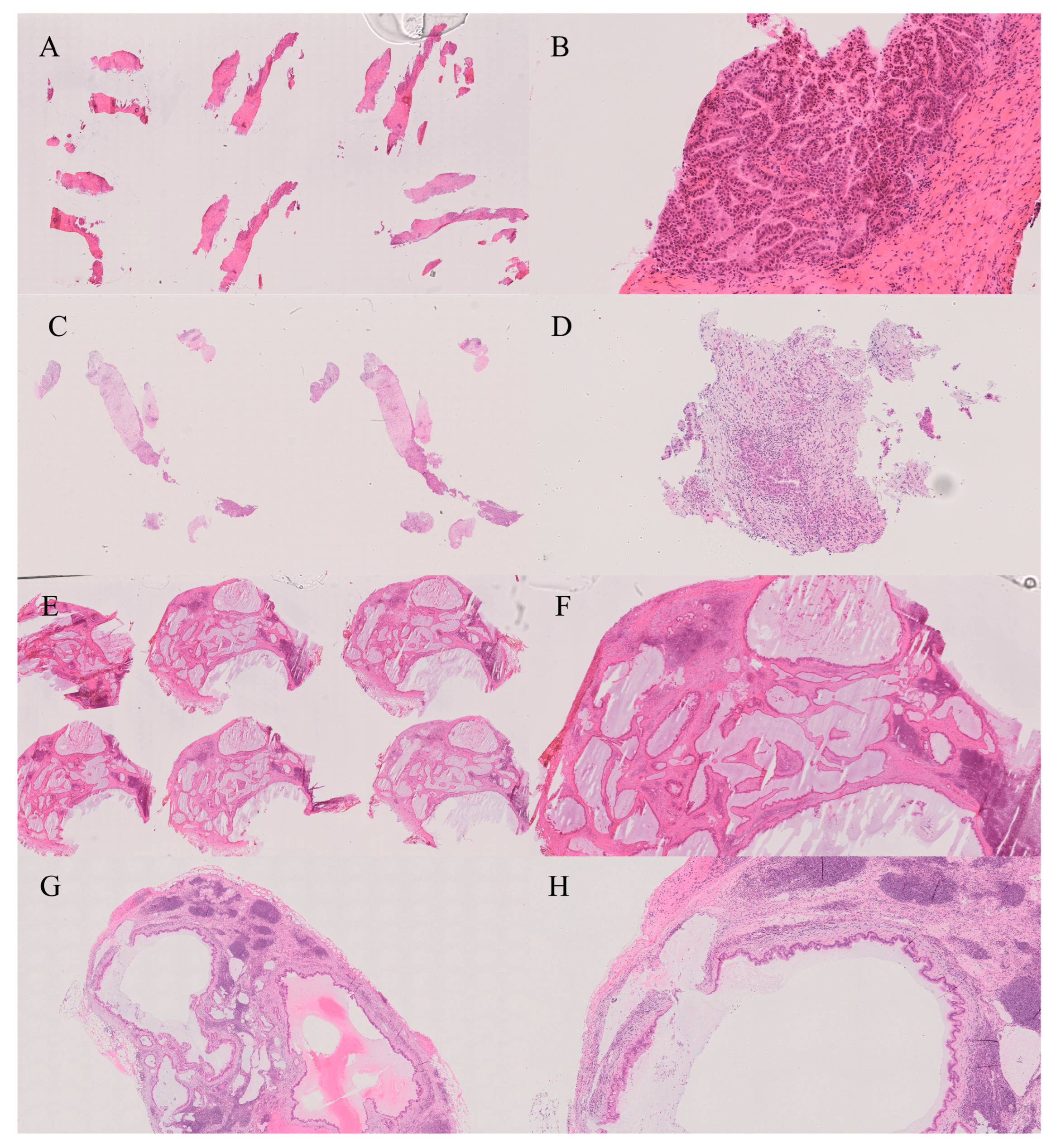 Gastroent 16 00046 g010 Gastroent 16 00046 g010