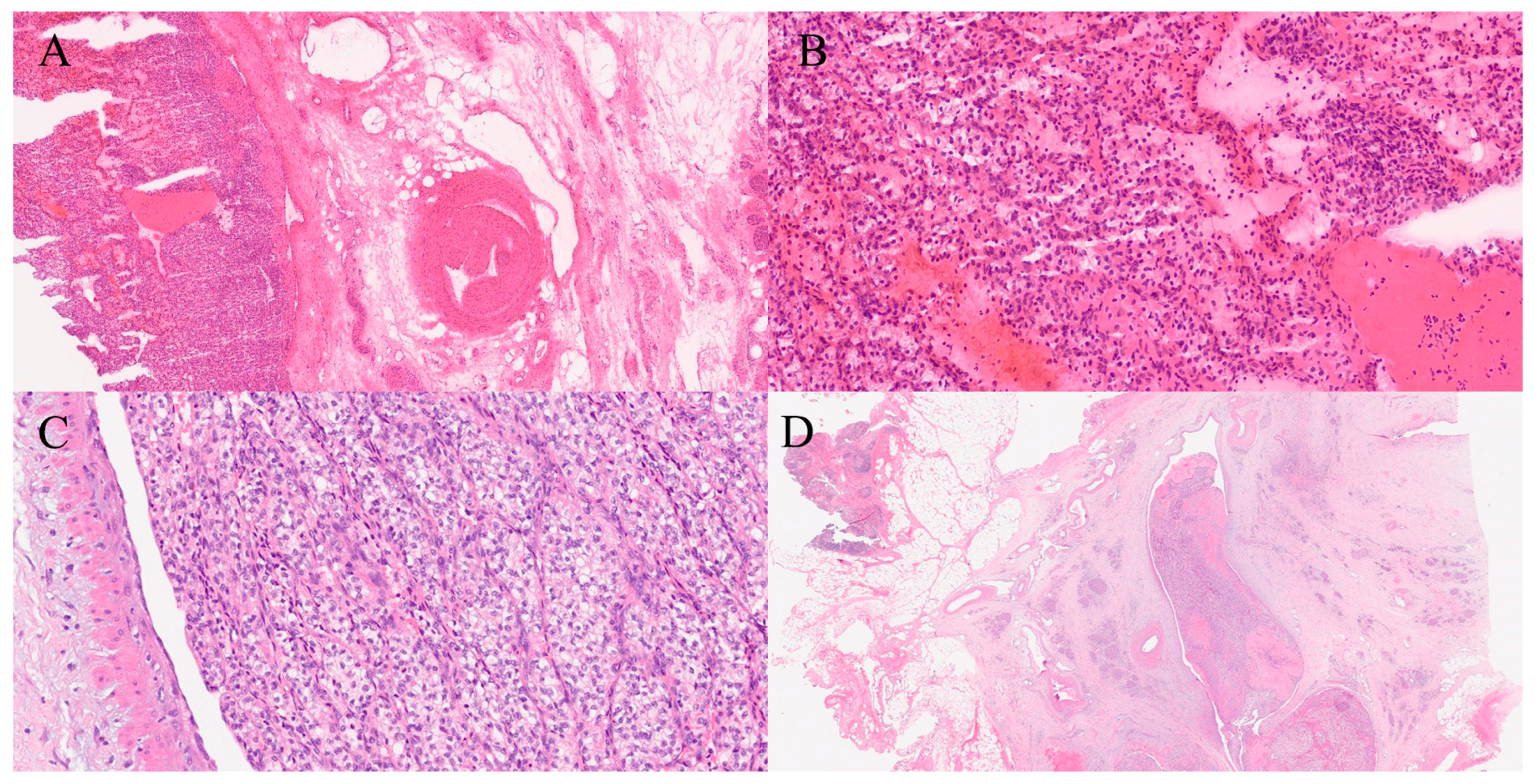 Gastroent 16 00046 g011 Gastroent 16 00046 g011