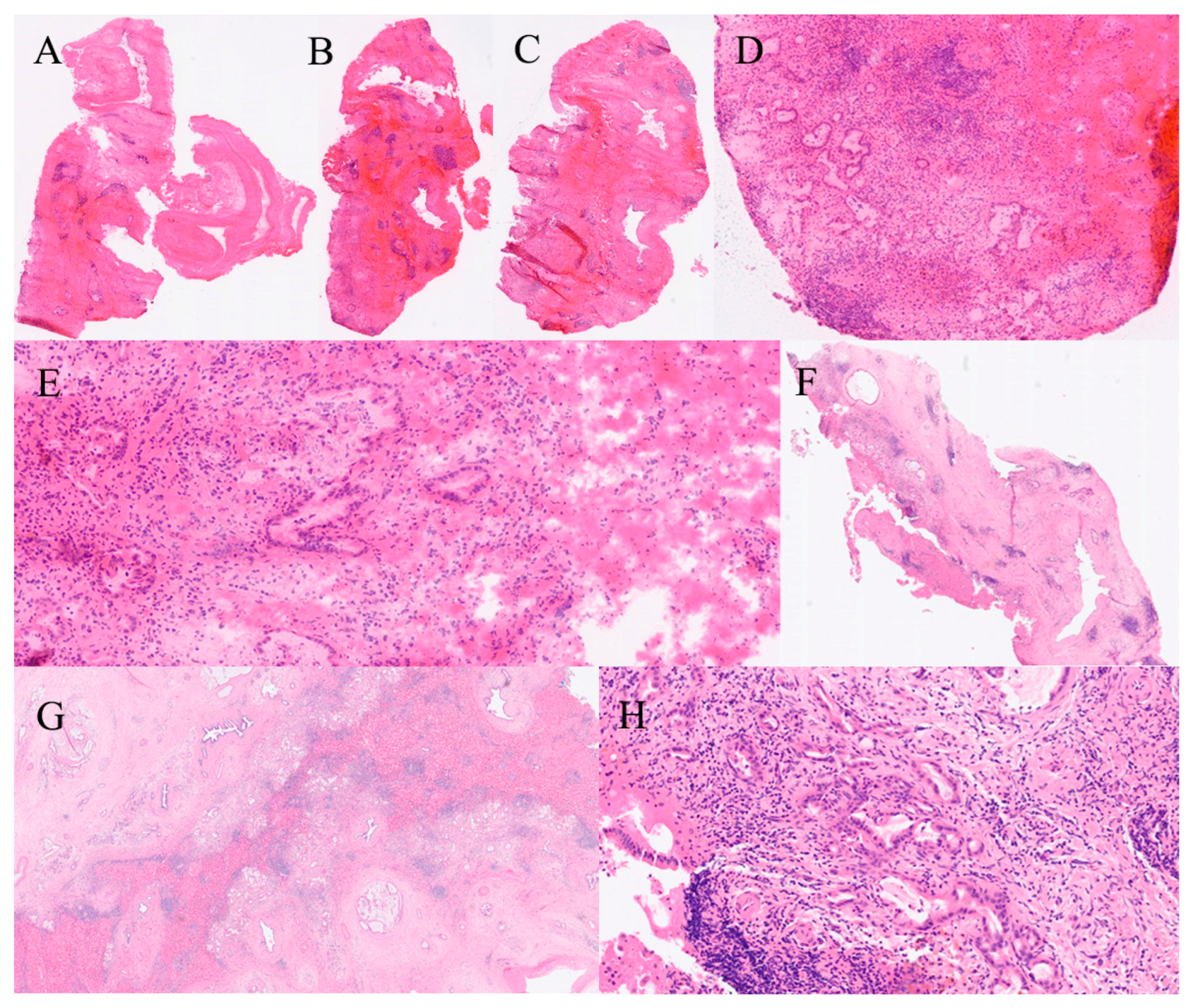 Gastroent 16 00046 g013 Gastroent 16 00046 g013