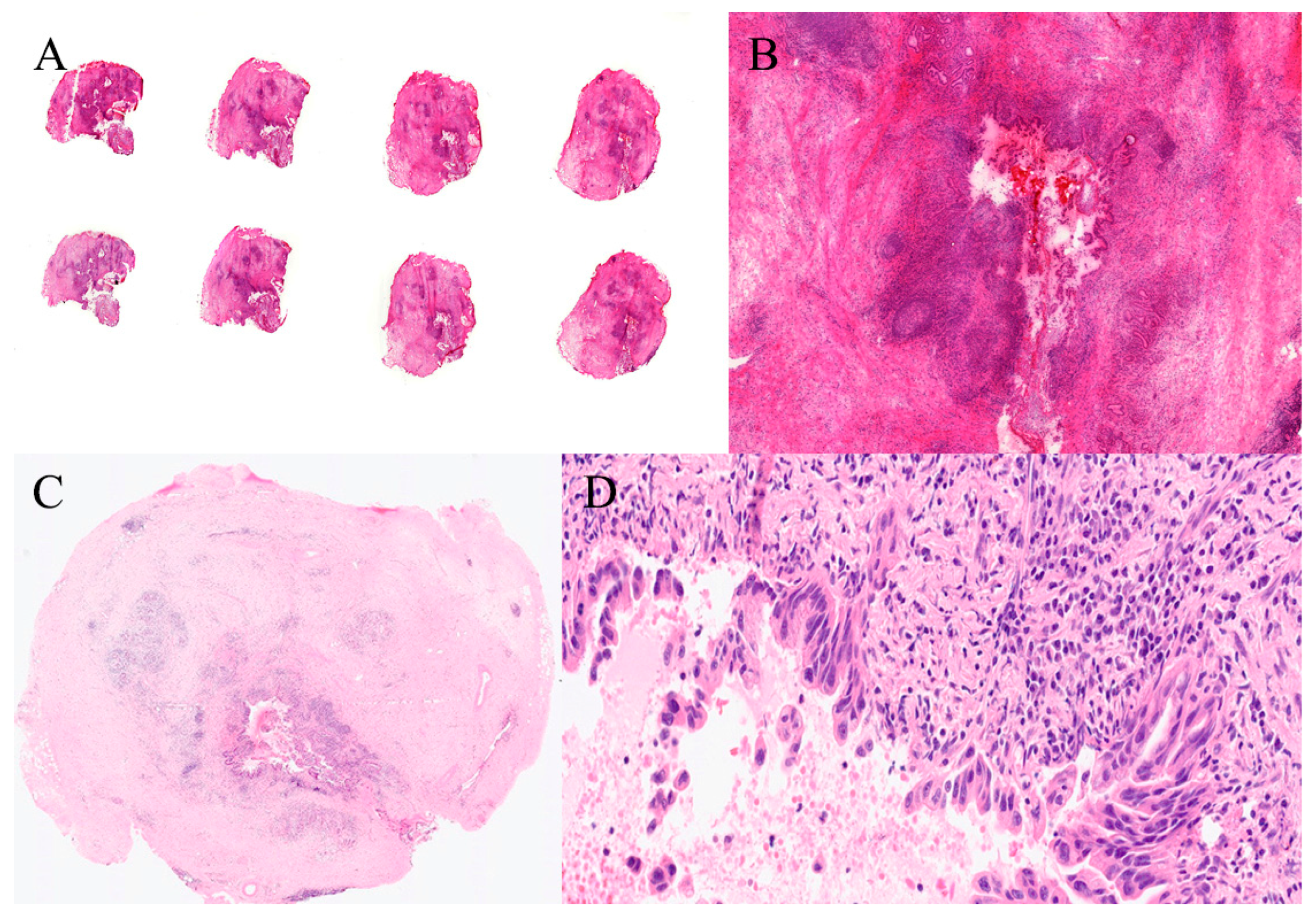 Gastroent 16 00046 g014 Gastroent 16 00046 g014