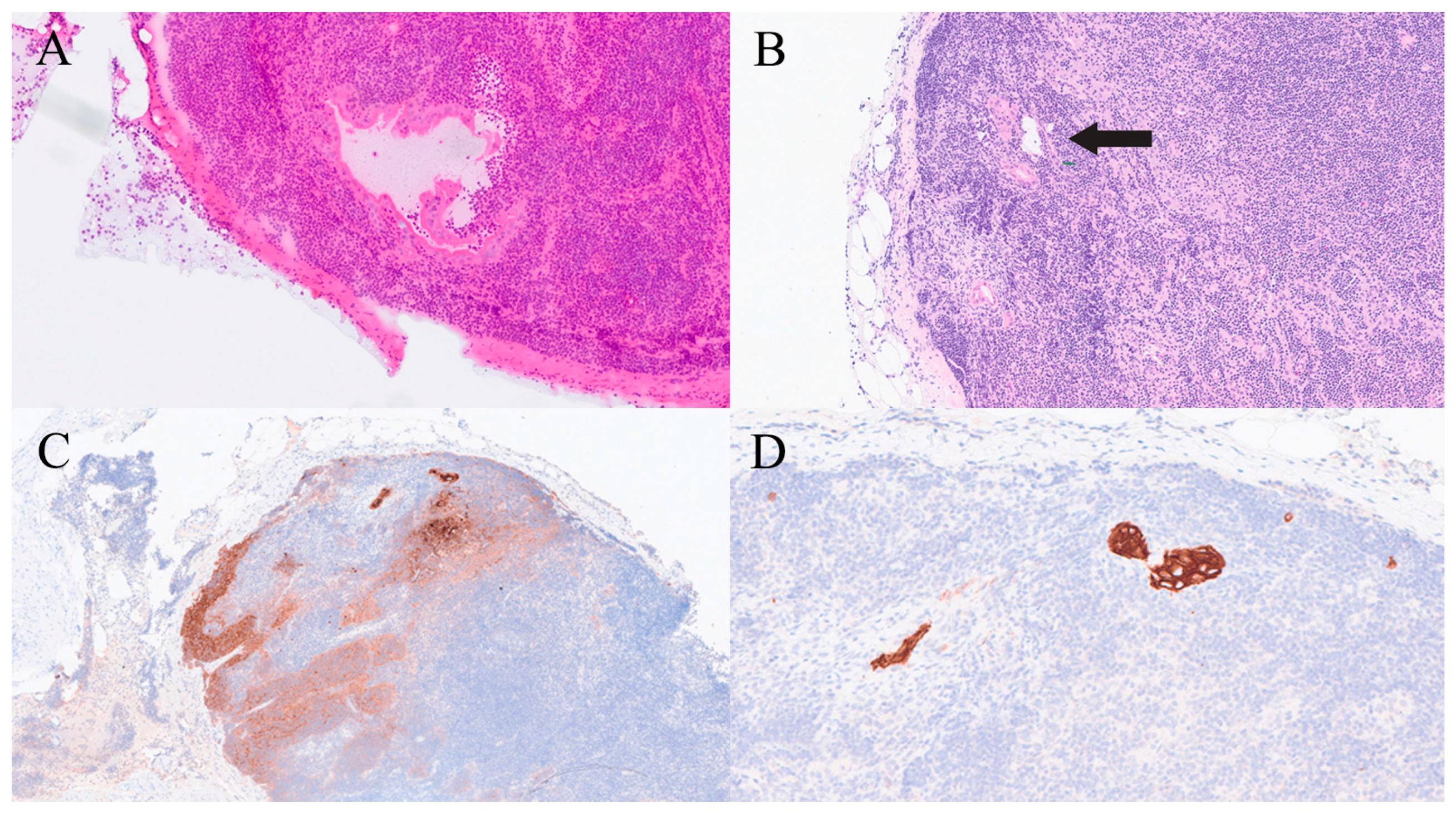 Gastroent 16 00046 g016 Gastroent 16 00046 g016