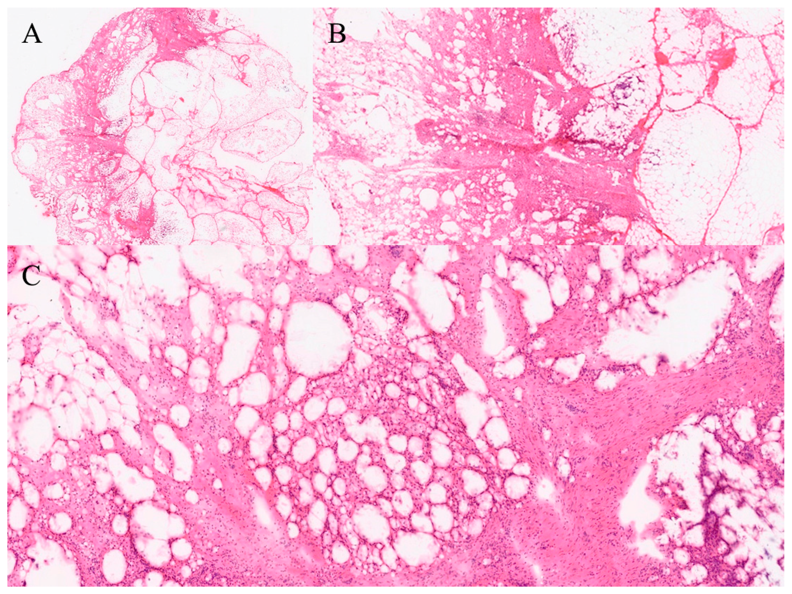 Gastroent 16 00046 g017 Gastroent 16 00046 g017