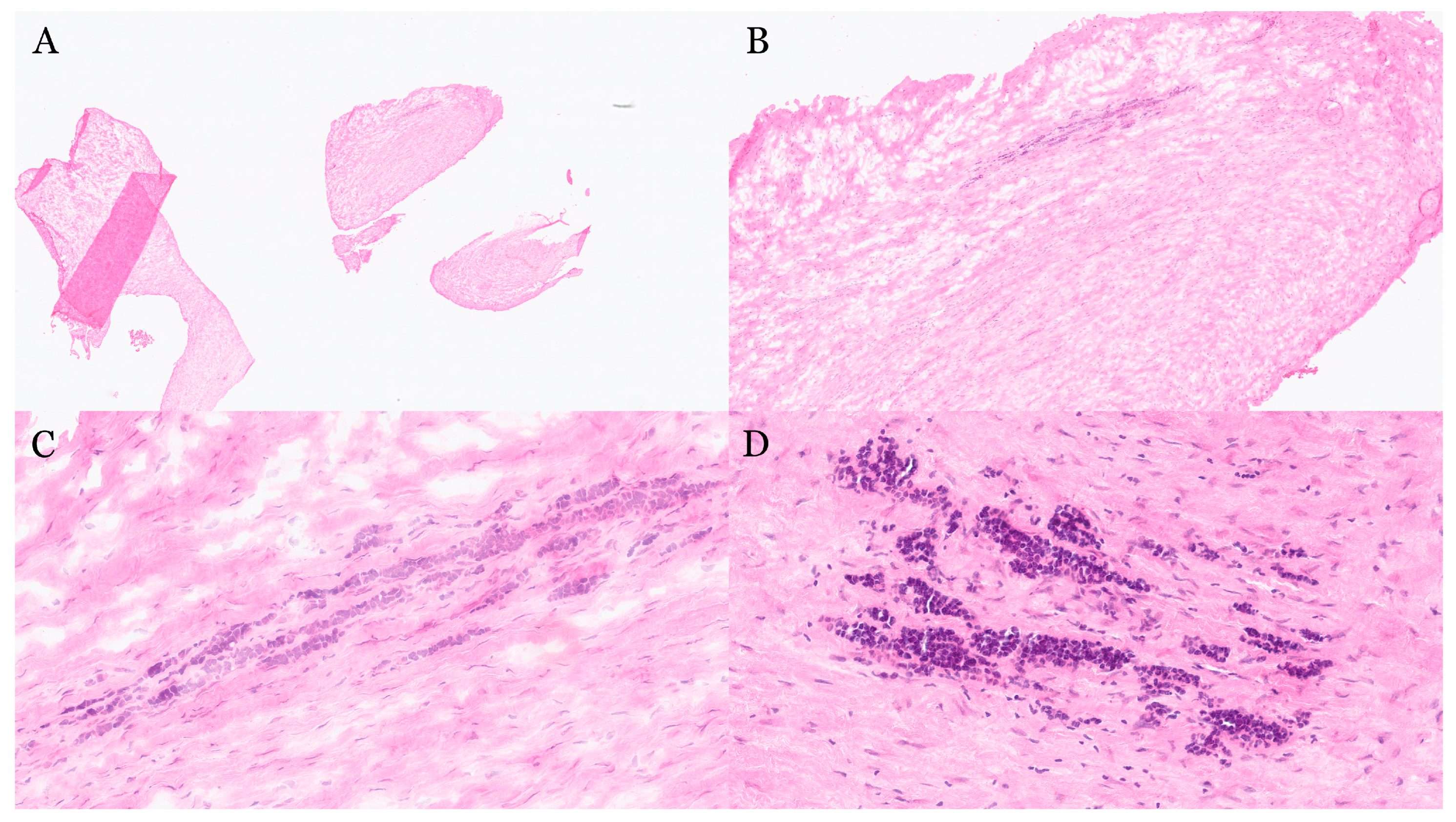Gastroent 16 00046 g018 Gastroent 16 00046 g018