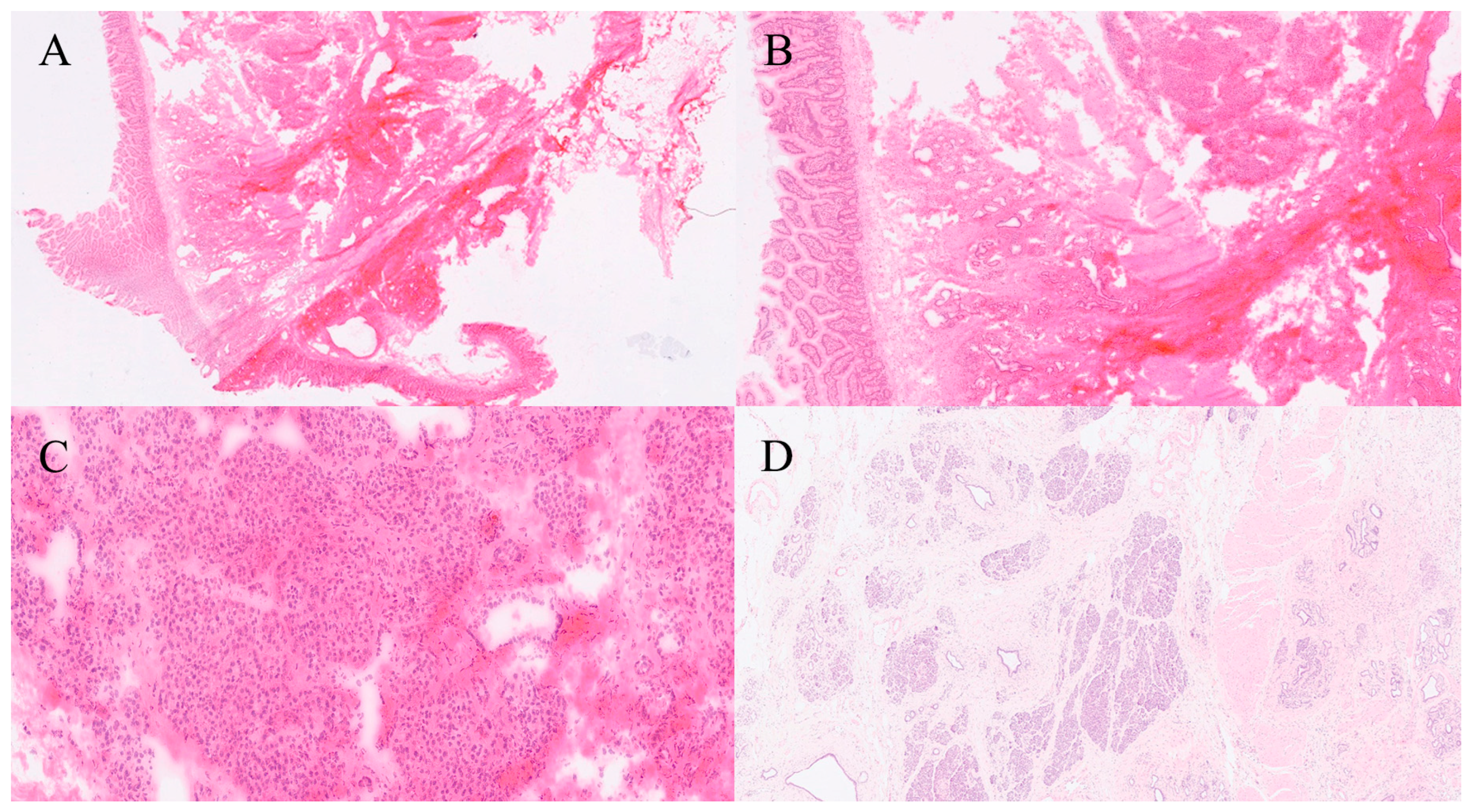 Gastroent 16 00046 g019 Gastroent 16 00046 g019