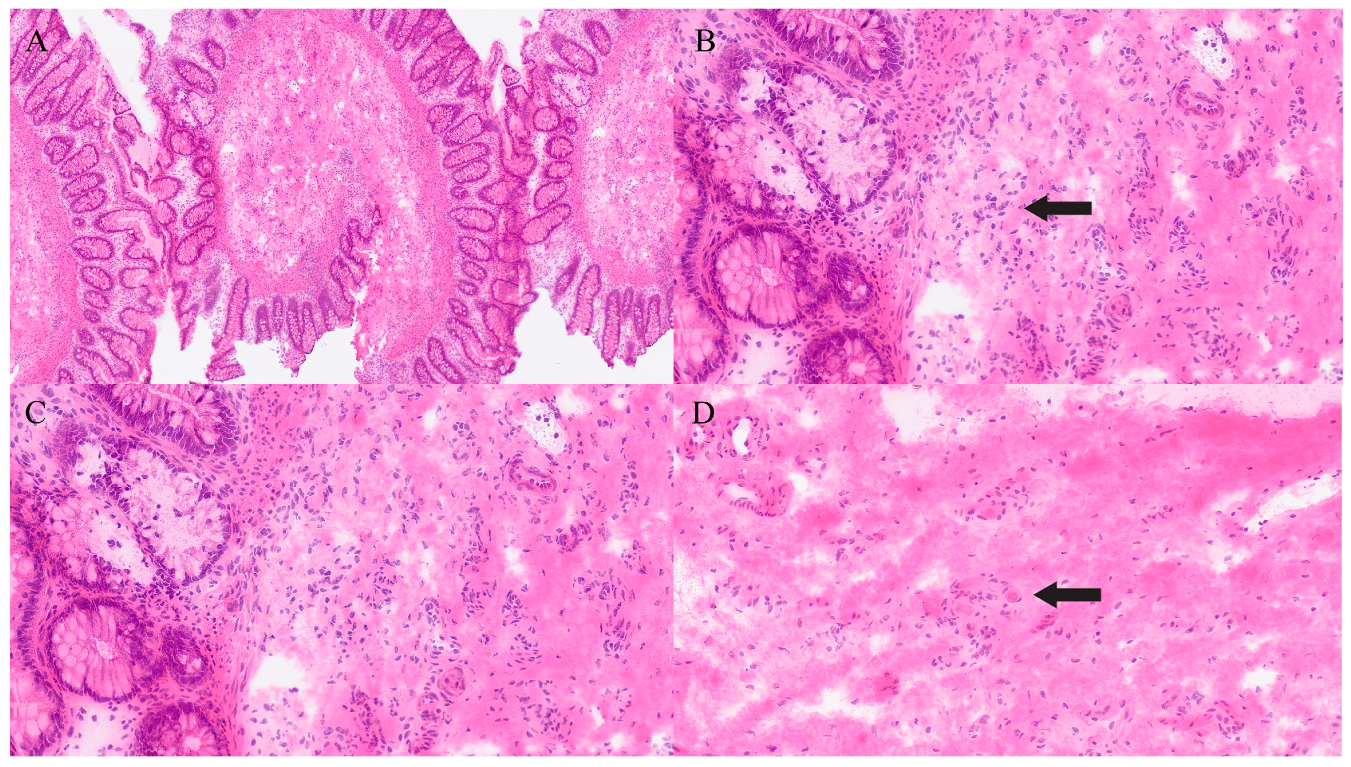 Gastroent 16 00046 g021 Gastroent 16 00046 g021